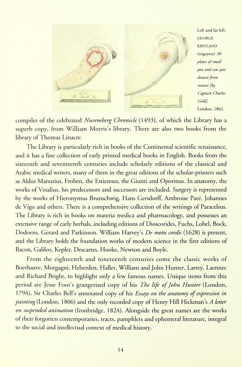 Left and far left: GEORGE KIRTLAND (engraver) 30 plates ofsmall pox and cow pox drawn from nature [by Captain Charles Gold], London, 1802. compiler of the celebrated Nuremberg Chronicle (1493), of which the Library has a superb copy, from William Morris's library. There are also two books from the library of Thomas Linacre. The Library is particularly rich in books of the Continental scientific renaissance, and it has a fine collection of early printed medical books in English. Books from the sixteenth and seventeenth centuries include scholarly editions of the classical and Arabic medical writers, many of them in the great editions of the scholar-printers such as Aldus Manutius, Froben, the Estiennes, the Giunti and Oporinus. In anatomy, the works of Vesalius, his predecessors and successors are included. Surgery is represented by the works of Hieronymus Brunschwig, Hans Gersdorff, Ambroise Pare, Johannes de Vigo and others. There is a comprehensive collection of the writings of Paracelsus. The Library is rich in books on materia medica and pharmacology, and possesses an extensive range of early herbals, including editions of Dioscorides, Fuchs, Lobel, Bock, Dodoens, Gerard and Parkinson. William Harvey's De motu cordis (1628) is present, and the Library holds the foundation works of modern science in the first editions of Bacon, Galileo, Kepler, Descartes, Hooke, Newton and Boyle. From the eighteenth and nineteenth centuries come the classic works of Boerhaave, Morgagni, Heberden, Haller, William and John Hunter, Larrey, Laennec and Richard Bright, to highlight only a few famous names. Unique items from this period are Jesse Foot's grangerised copy of his The life of John Hunter (London, 1794), Sir Charles Bell's annotated copy of his Essays on the anatomy of expression in painting (London, 1806) and the only recorded copy of Henry Hill Hickman's A letter on suspended animation (Ironbridge, 1824). Alongside the great names are the works of their forgotten contemporaries, tracts, pamphlets and ephemeral literature, integral to the social and intellectual context of medical history.
