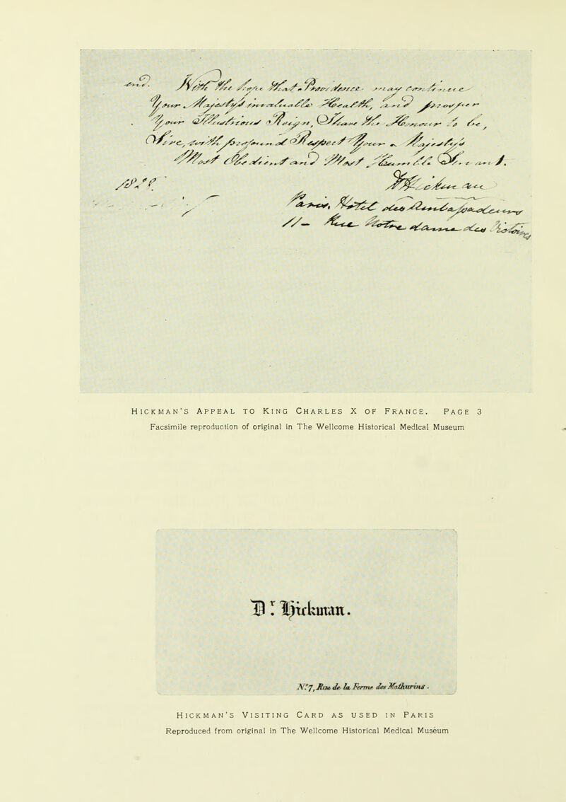 <5~) rttfszte ■ ssi ,*-y r/r-s. r,*, jr. //s ■ A • s ^r?> - w <r O J. Hickman's Appeal to King Charles X of France. Page 3 Facsimile reproduction of original in The Wellcome Historical Medical Museum .V.7,JPu»<& laFermr Jr.< MiAuritis ■ Hickman's Visiting Card as used in Paris