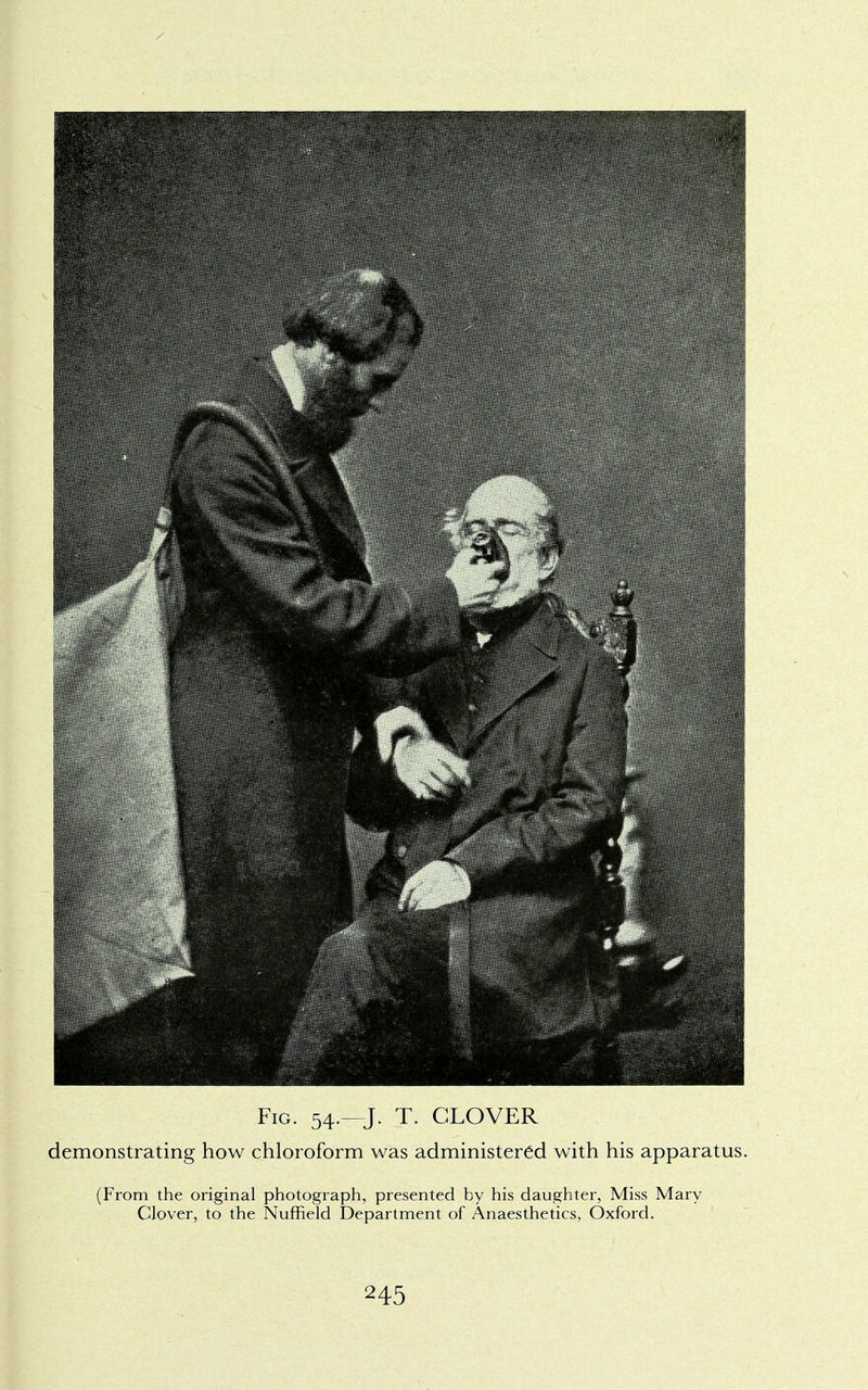 Fig. 54.—J. T. GLOVER demonstrating how chloroform was administered with his apparatus. (From the original photograph, presented by his daughter, Miss Mary Clover, to the Nuffield Department of Anaesthetics, Oxford.