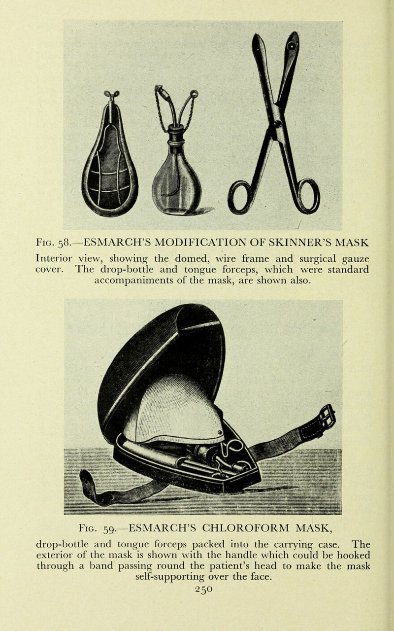 Fig. 58.—ESMARCH'S MODIFICATION OF SKINNER'S MASK Interior view, showing the domed, wire frame and surgical gauze cover. The drop-bottle and tongue forceps, which were standard accompaniments of the mask, are shown also. Fig. 59.—ESMARCH'S CHLOROFORM MASK, drop-bottle and tongue forceps packed into the carrying case. The exterior of the mask is shown with the handle which could be hooked through a band passing round the patient's head to make the mask self-supporting over the face.