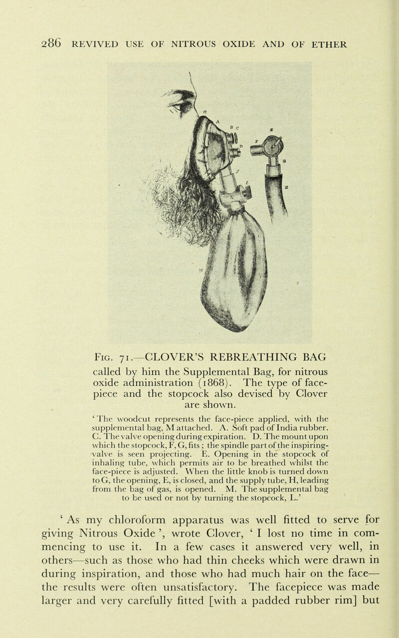 Fig. 71.—CLOVER'S REBREATHING BAG called by him the Supplemental Bag, for nitrous oxide administration (1868). The type of face- piece and the stopcock also devised by Clover are shown. ' The woodcut represents the face-piece applied, with the supplemental bag, M attached. A. Soft pad of India rubber. C. The valve opening during expiration. D. The mount upon which the stopcock, F, G, fits ; the spindle part of the inspiring- valve is seen projecting. E. Opening in the stopcock of inhaling tube, which permits air to be breathed whilst the face-piece is adjusted. When the little knob is turned down to G, the opening, E, is closed, and the supply tube, H, leading from the bag of gas, is opened. M. The supplemental bag to be used or not by turning the stopcock, L.' ' As my chloroform apparatus was well fitted to serve for giving Nitrous Oxide wrote Clover, ' I lost no time in com- mencing to use it. In a few cases it answered very well, in others—such as those who had thin cheeks which were drawn in during inspiration, and those who had much hair on the face— the results were often unsatisfactory. The facepiece was made larger and very carefully fitted [with a padded rubber rim] but