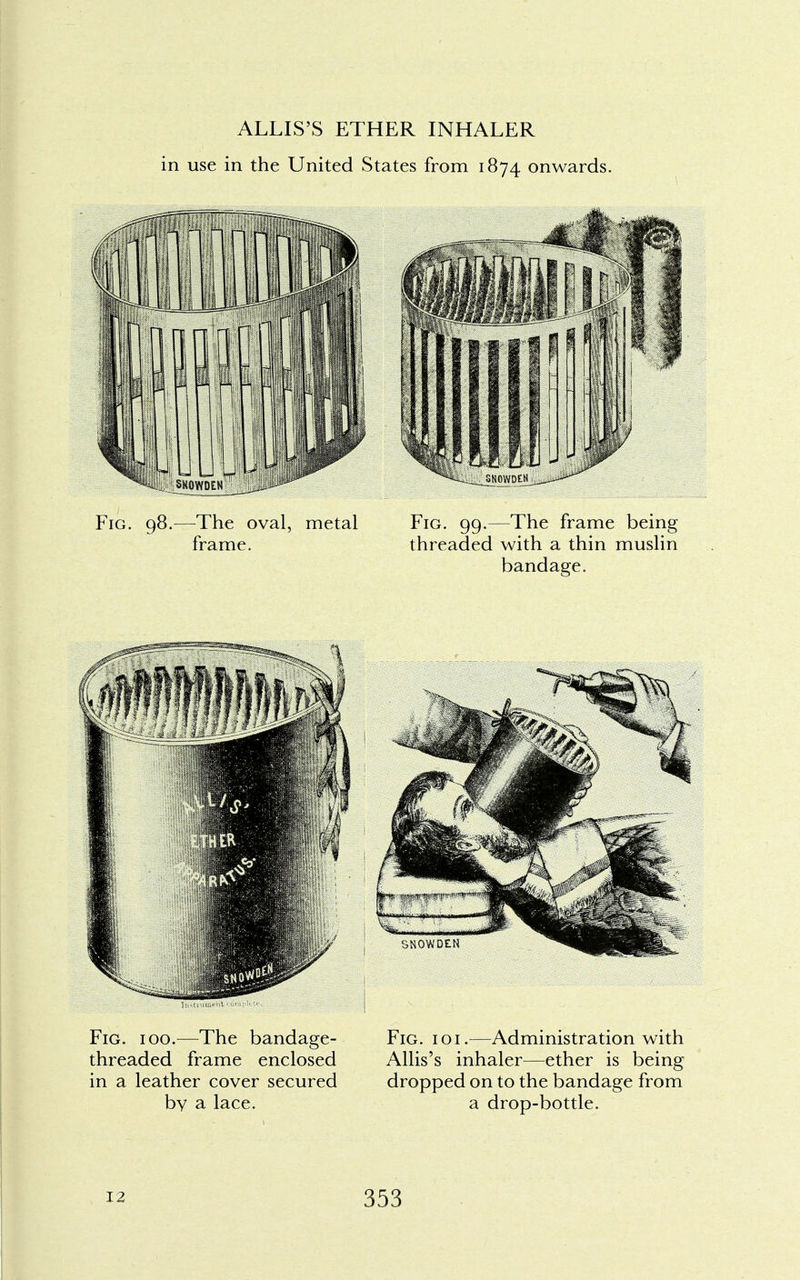 ALLIS'S ETHER INHALER in use in the United States from 1874 onwards. Fig. 98.—The oval, metal Fig. 99.—The frame being frame. threaded with a thin muslin bandage.