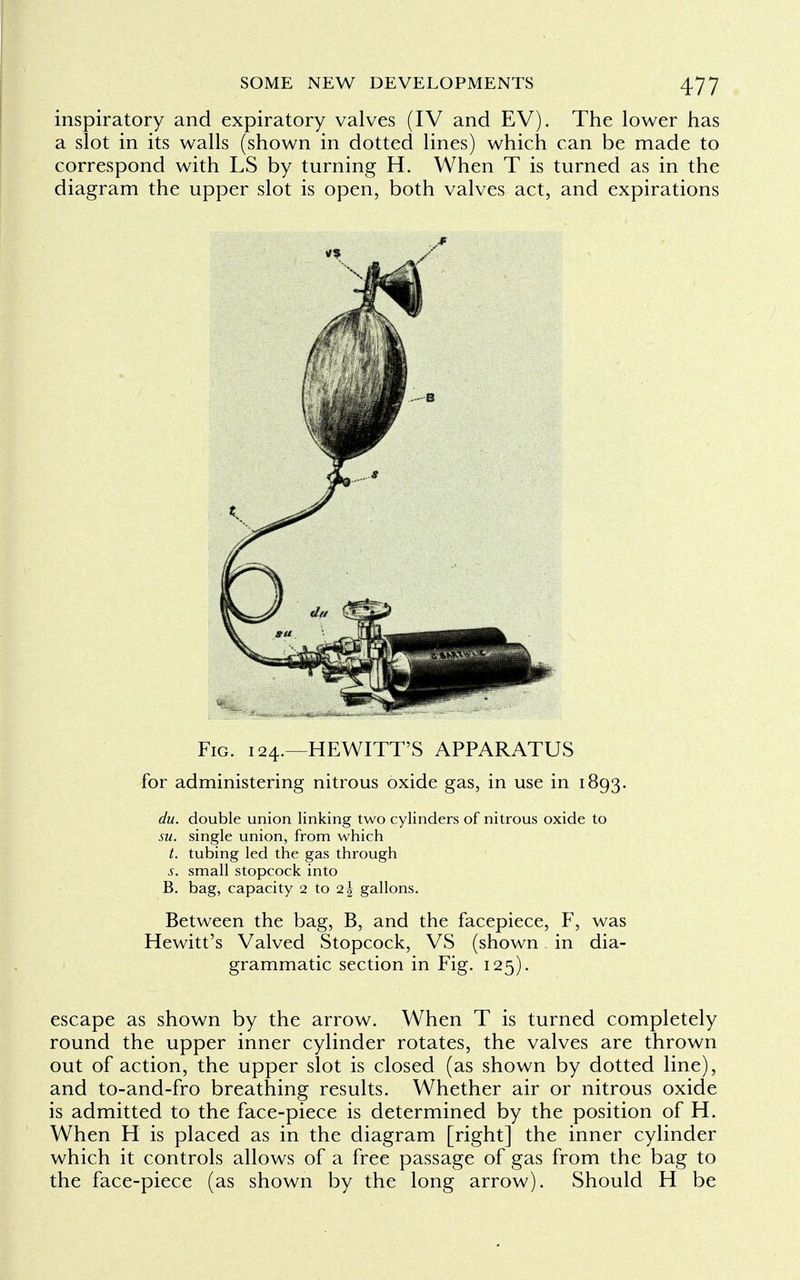 inspiratory and expiratory valves (IV and EV). The lower has a slot in its walls (shown in dotted lines) which can be made to correspond with LS by turning H. When T is turned as in the diagram the upper slot is open, both valves act, and expirations Fig. i 24.—HEWITT'S APPARATUS for administering nitrous oxide gas, in use in 1893. du. double union linking two cylinders of nitrous oxide to su. single union, from which t. tubing led the gas through s. small stopcock into B. bag, capacity 2 to <z\ gallons. Between the bag, B, and the facepiece, F, was Hewitt's Valved Stopcock, VS (shown in dia- grammatic section in Fig. 125). escape as shown by the arrow. When T is turned completely round the upper inner cylinder rotates, the valves are thrown out of action, the upper slot is closed (as shown by dotted line), and to-and-fro breathing results. Whether air or nitrous oxide is admitted to the face-piece is determined by the position of H. When H is placed as in the diagram [right] the inner cylinder which it controls allows of a free passage of gas from the bag to the face-piece (as shown by the long arrow). Should H be