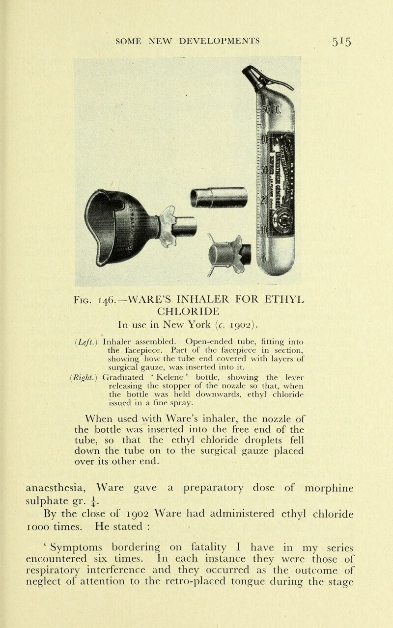 Fig. 146.—WARE'S INHALER FOR ETHYL CHLORIDE In use in New York (c. 1902). (Left.) Inhaler assembled. Open-ended tube, fitting into the facepiece. Part of the facepiece in section, showing how the tube end covered with layers of surgical gauze, was inserted into it. (Right.) Graduated ' Kelene ' bottle, showing the lever releasing the stopper of the nozzle so that, when the bottle was held downwards, ethyl chloride issued in a fine spray. When used with Ware's inhaler, the nozzle of the bottle was inserted into the free end of the tube, so that the ethyl chloride droplets fell down the tube on to the surgical gauze placed over its other end. anaesthesia, Ware gave a preparatory dose of morphine sulphate gr. \. By the close of 1902 Ware had administered ethyl chloride 1000 times. He stated : ' Symptoms bordering on fatality I have in my series encountered six times. In each instance they were those of respiratory interference and they occurred as the outcome of neglect of attention to the retro-placed tongue during the stage