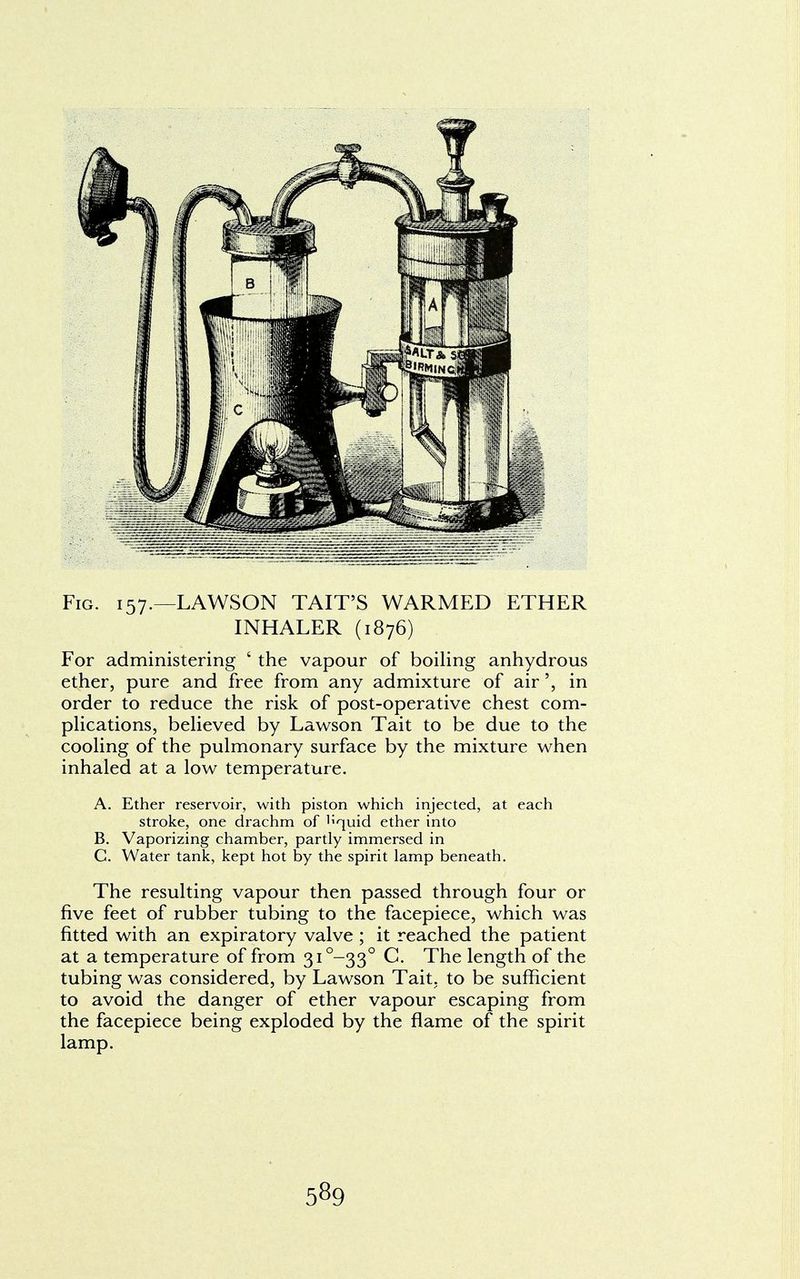 Fig. 157.—LAWSON TAIT'S WARMED ETHER INHALER (1876) For administering ' the vapour of boiling anhydrous ether, pure and free from any admixture of airin order to reduce the risk of post-operative chest com- plications, believed by Lawson Tait to be due to the cooling of the pulmonary surface by the mixture when inhaled at a low temperature. A. Ether reservoir, with piston which injected, at each stroke, one drachm of i;quid ether into B. Vaporizing chamber, partly immersed in C. Water tank, kept hot by the spirit lamp beneath. The resulting vapour then passed through four or five feet of rubber tubing to the facepiece, which was fitted with an expiratory valve ; it reached the patient at a temperature of from 3i°-33° C. The length of the tubing was considered, by Lawson Tait, to be sufficient to avoid the danger of ether vapour escaping from the facepiece being exploded by the flame of the spirit lamp.