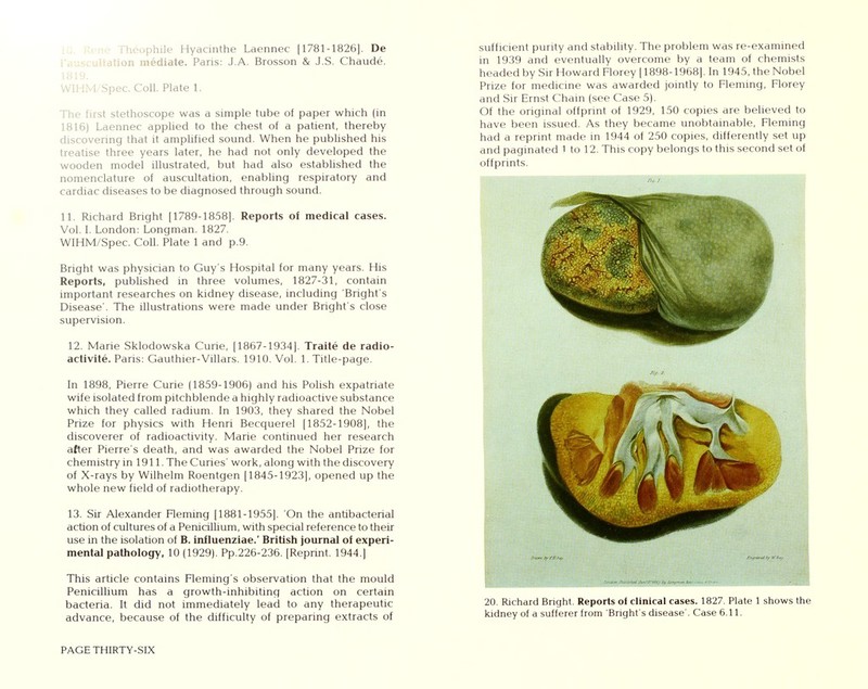 eophile Hyacinthe Laennec [1781-1826]. De tion mediate. Paris: J.A. Brosson & J.S. Chaude. WIHM/Spec. Coll. Plate 1. The first stethoscope was a simple tube of paper which (in 1816) Laennec applied to the chest of a patient, thereby discovering that it amplified sound. When he published his treatise three years later, he had not only developed the wooden model illustrated, but had also established the nomenclature of auscultation, enabling respiratory and cardiac diseases to be diagnosed through sound. 11. Richard Bright (1789-1858). Reports of medical cases. Vol. I. London: Longman. 1827. WIHM/Spec. Coll. Plate 1 and p.9. Bright was physician to Guy's Hospital for many years. His Reports, published in three volumes, 1827-31, contain important researches on kidney disease, including Bright's Disease'. The illustrations were made under Bright's close supervision. 12. Mane Sklodowska Curie, [1867-1934]. Traite de radio- activite. Paris: Gauthier-Villars. 1910. Vol. 1. Title-page. In 1898, Pierre Curie (1859-1906) and his Polish expatriate wife isolated from pitchblende a highly radioactive substance which they called radium. In 1903, they shared the Nobel Prize for physics with Henri Becquerel [1852-1908], the discoverer of radioactivity. Marie continued her research after Pierre's death, and was awarded the Nobel Prize for chemistry in 1911. The Curies' work, along with the discovery of X-rays by Wilhelm Roentgen [1845-1923], opened up the whole new field of radiotherapy. 13. Sir Alexander Fleming [1881-1955]. On the antibacterial action of cultures of a Penicilhum, with special reference to their use in the isolation of B. iniluenziae.' British journal of experi- mental pathology, 10 (1929). Pp.226-236. [Repnnt. 1944.] This article contains Fleming's observation that the mould Penicilhum has a growth-inhibiting action on certain bacteria. It did not immediately lead to any therapeutic advance, because of the difficulty of preparing extracts of sufficient purity and stability. The problem was re-examined in 1939 and eventually overcome by a team of chemists headed by Sir Howard Florey [1898-1968). In 1945, the Nobel Prize for medicine was awarded jointly to Fleming, Florey and Sir Ernst Chain (see Case 5). Of the original offprint of 1929, 150 copies are believed to have been issued. As they became unobtainable, Fleming had a reprint made in 1944 of 250 copies, differently set up and paginated 1 to 12. This copy belongs to this second set of offprints. 20. Richard Bnght. Reports of clinical cases. 1827. Plate 1 shows the kidney of a sufferer from Bright's disease'. Case 6.11.