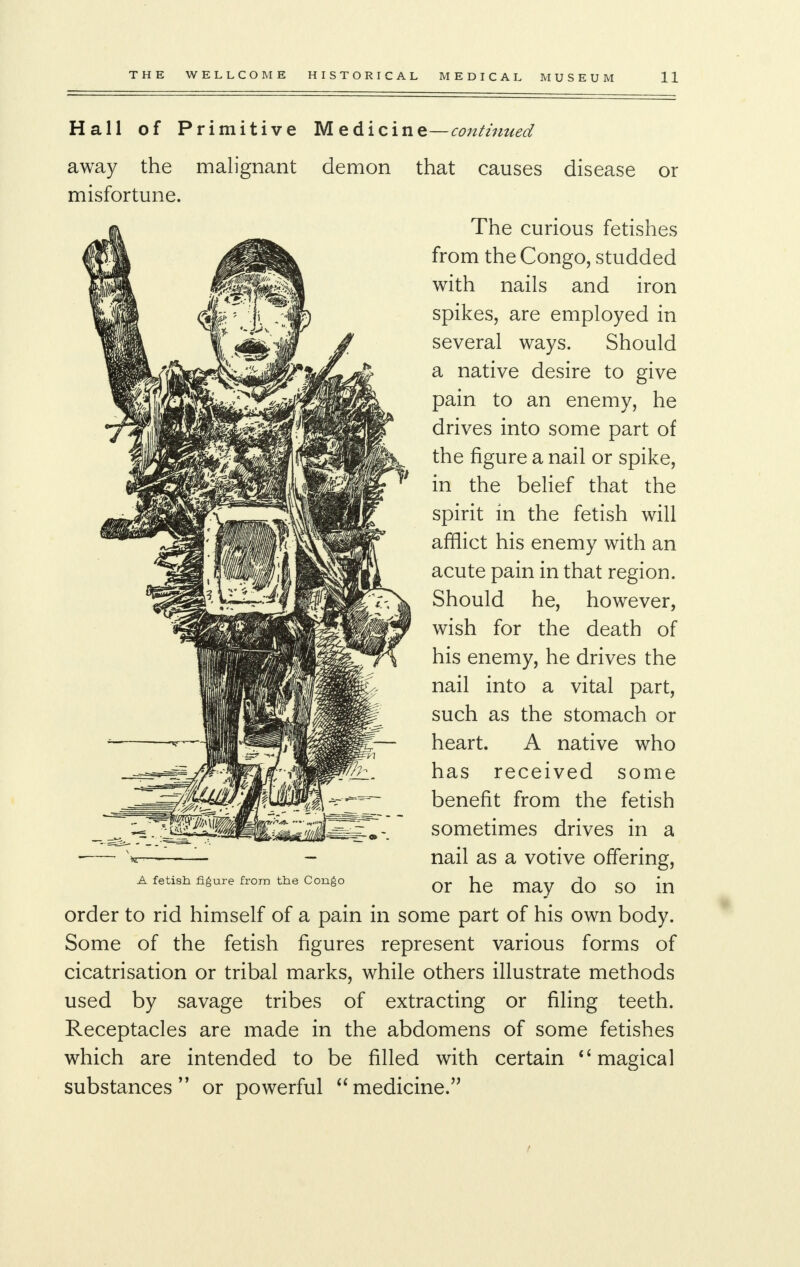 Hall of Primitive M edicine—continued away the malignant demon that causes disease or misfortune. The curious fetishes from the Congo, studded with nails and iron spikes, are employed in several ways. Should a native desire to give pain to an enemy, he drives into some part of the figure a nail or spike, in the belief that the spirit in the fetish will afflict his enemy with an acute pain in that region. Should he, however, wish for the death of his enemy, he drives the nail into a vital part, such as the stomach or heart. A native who has received some benefit from the fetish sometimes drives in a nail as a votive offering, or he may do so in order to rid himself of a pain in some part of his own body. Some of the fetish figures represent various forms of cicatrisation or tribal marks, while others illustrate methods used by savage tribes of extracting or filing teeth. Receptacles are made in the abdomens of some fetishes which are intended to be filled with certain  magical substances  or powerful  medicine. A fetish figure from the Congo