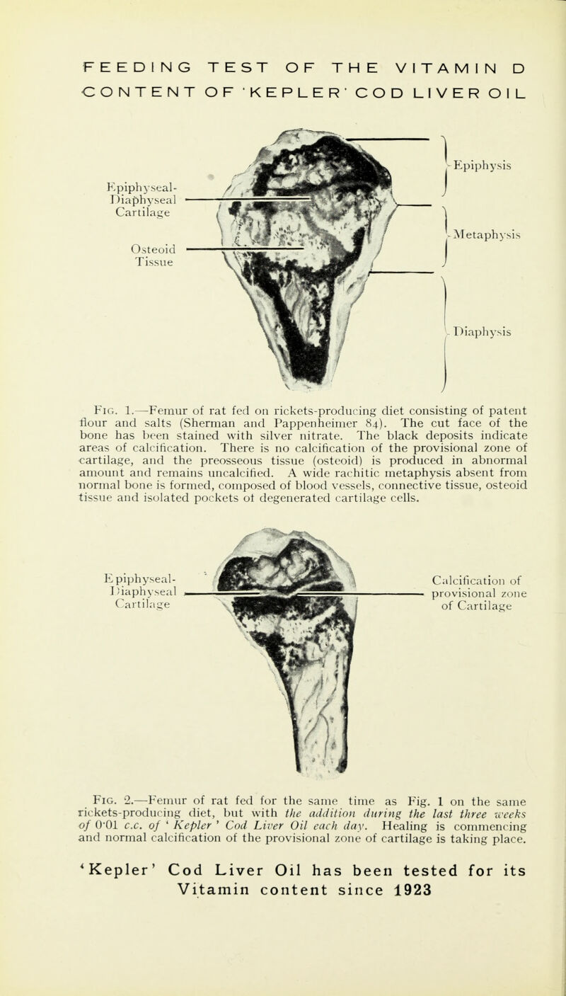 FEEDING TEST OF THE VITAMIN D CONTENT OF KEPLER' COD LIVER OIL Fig. 1.—Femur of rat fed on rickets-producing diet consisting of patent ilour and salts (Sherman and Pappenheimer 84). The cut face of the bone has been stained with silver nitrate. The black deposits indicate areas of calciftcation. There is no calcification of the provisional zone of -cartilage, and the preosseous tissue (osteoid) is produced in abnormal amount and remains uncalcified. A wide rachitic metaphysis absent from normal bone is formed, composed of blood vessels, connective tissue, osteoid tissue and isolated pockets oi degenerated cartilage cells. E piphyseal- Diaphyseal Cartilage Calcification of provisional zone of Cartilage Fig. 2.—Femur of rat fed for the same time as Fig. 1 on the same rickets-producing diet, but with the addition during the last three tveeks of 0*01 ex. of ' Kepler ' Cod Liver Oil each day. Healing is commencing and normal calcification of the provisional zone of cartilage is taking place. 'Kepler' Cod Liver Oil has been tested for its Vitamin content since 1923