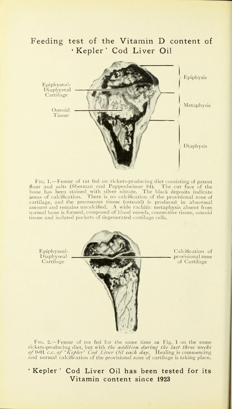 Feeding- test of the Vitamin * Kepler ' Cod Liver D content Oil of Epiphyseal- Diaphyseal Cartilage Osteoid Tissue Fig. 1.—Femur of rat fed on rickets-producing diet consisting of patent flour and salts (Sherman and Pappenheimer 84). The cut face of the bone has been stained with silver nitrate. The black deposits indicate areas of calcification. There is no calcification of the provisional zone of cartilage, and the preosseous tissue (osteoid) is produced in abnormal amount, and remains uncalcified. A wide rachitic metaphysis absent from normal bone is formed, composed of blood vessels, connective tissue, osteoid tissue and isolated pockets of degenerated cartilage cells. Calcification of provisional zone of Cartilage Fig. 2.—Femur of rat fed for the same time as Fig. 1 on the same rickets-producing diet, but with the addition during- the last three weeks 0/O-Ol c.c. of 1Kepler' Cod Liver Oil each day. Healing is commencing and normal calcification of the provisional zone of cartilage is taking place. ' Kepler ' Cod Liver Oil has been tested for its