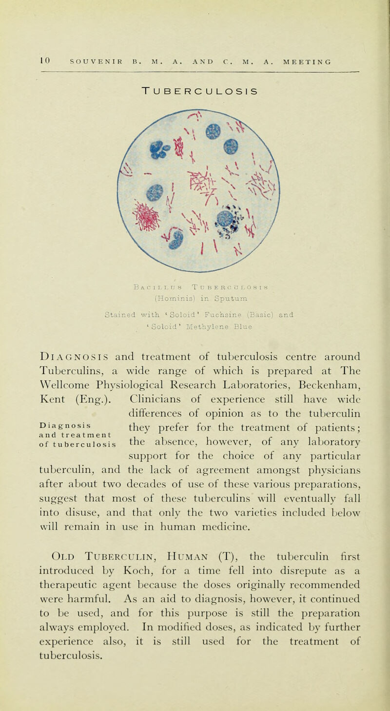 Tuberculosis (Hominis) in Sputum Stained with 1 Soloid' Fuchsine (Basic) and 'Soloid' Methylene Blue Diagnosis and treatment of tuberculosis centre around Tuberculins, a wide range of which is prepared at The Wellcome Physiological Research Laboratories, Beckenham, Kent (Eng.). Clinicians of experience still have wide differences of opinion as to the tuberculin Diagnosis ^ they prefer for the treatment of patients; of tuberculosis the absence, however, of any laboratory support for the choice of any particular tuberculin, and the lack of agreement amongst physicians after about two decades of use of these various preparations, suggest that most of these tuberculins will eventually fall into disuse, and that only the two varieties included below will remain in use in human medicine. Old Tuberculin, Human (T), the tuberculin first introduced by Koch, for a time fell into disrepute as a therapeutic agent because the doses originally recommended were harmful. As an aid to diagnosis, however, it continued to be used, and for this purpose is still the preparation always employed. In modified doses, as indicated by further experience also, it is still used for the treatment of tuberculosis.