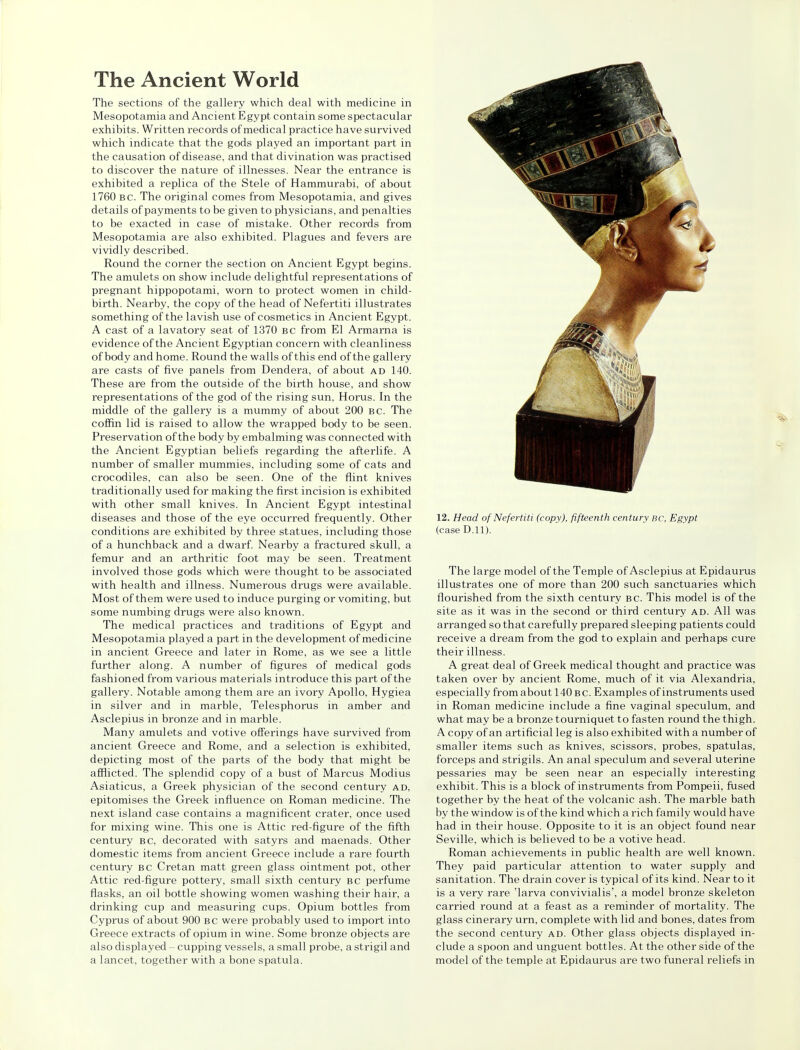 The Ancient World The sections of the gallery which deal with medicine in Mesopotamia and Ancient Egypt contain some spectacular exhibits. Written records of medical practice have survived which indicate that the gods played an important part in the causation of disease, and that divination was practised to discover the nature of illnesses. Near the entrance is exhibited a replica of the Stele of Hammurabi, of about 1760 bc. The original comes from Mesopotamia, and gives details of payments to be given to physicians, and penalties to be exacted in case of mistake. Other records from Mesopotamia are also exhibited. Plagues and fevers are vividly described. Round the corner the section on Ancient Egypt begins. The amulets on show include delightful representations of pregnant hippopotami, worn to protect women in child- birth. Nearby, the copy of the head of Nefertiti illustrates something of the lavish use of cosmetics in Ancient Egypt. A cast of a lavatory seat of 1370 bc from El Armarna is evidence of the Ancient Egyptian concern with cleanliness of body and home. Round the walls of this end of the gallery are casts of five panels from Dendera, of about ad 140. These are from the outside of the birth house, and show representations of the god of the rising sun, Horus. In the middle of the gallery is a mummy of about 200 bc. The coffin lid is raised to allow the wrapped body to be seen. Preservation of the body by embalming was connected with the Ancient Egyptian beliefs regarding the afterlife. A number of smaller mummies, including some of cats and crocodiles, can also be seen. One of the flint knives traditionally used for making the first incision is exhibited with other small knives. In Ancient Egypt intestinal diseases and those of the eye occurred frequently. Other conditions are exhibited by three statues, including those of a hunchback and a dwarf. Nearby a fractured skull, a femur and an arthritic foot may be seen. Treatment involved those gods which were thought to be associated with health and illness. Numerous drugs were available. Most of them were used to induce purging or vomiting, but some numbing drugs were also known. The medical practices and traditions of Egypt and Mesopotamia played a part in the development of medicine in ancient Greece and later in Rome, as we see a little further along. A number of figures of medical gods fashioned from various materials introduce this part of the gallery. Notable among them are an ivory Apollo, Hygiea in silver and in marble, Telesphorus in amber and Asclepius in bronze and in marble. Many amulets and votive offerings have survived from ancient Greece and Rome, and a selection is exhibited, depicting most of the parts of the body that might be afflicted. The splendid copy of a bust of Marcus Modius Asiaticus, a Greek physician of the second century ad, epitomises the Greek influence on Roman medicine. The next island case contains a magnificent crater, once used for mixing wine. This one is Attic red-figure of the fifth century bc, decorated with satyrs and maenads. Other domestic items from ancient Greece include a rare fourth century bc Cretan matt green glass ointment pot, other Attic red-figure pottery, small sixth century BC perfume flasks, an oil bottle showing women washing their hair, a drinking cup and measuring cups. Opium bottles from Cyprus of about 900 bc were probably used to import into Greece extracts of opium in wine. Some bronze objects are also displayed - cupping vessels, a small probe, a strigil and a lancet, together with a bone spatula. 12. Head of Nefertiti (copy), fifteenth century BC, Egypt (case D.11). The large model of the Temple of Asclepius at Epidaurus illustrates one of more than 200 such sanctuaries which flourished from the sixth century bc. This model is of the site as it was in the second or third century ad. All was arranged so that carefully prepared sleeping patients could receive a dream from the god to explain and perhaps cure their illness. A great deal of Greek medical thought and practice was taken over by ancient Rome, much of it via Alexandria, especially from about 140 bc. Examples of instruments used in Roman medicine include a fine vaginal speculum, and what may be a bronze tourniquet to fasten round the thigh. A copy of an artificial leg is also exhibited with a number of smaller items such as knives, scissors, probes, spatulas, forceps and strigils. An anal speculum and several uterine pessaries may be seen near an especially interesting exhibit. This is a block of instruments from Pompeii, fused together by the heat of the volcanic ash. The marble bath by the window is of the kind which a rich family would have had in their house. Opposite to it is an object found near Seville, which is believed to be a votive head. Roman achievements in public health are well known. They paid particular attention to water supply and sanitation. The drain cover is typical of its kind. Near to it is a very rare 'larva convivialis', a model bronze skeleton carried round at a feast as a reminder of mortality. The glass cinerary urn, complete with lid and bones, dates from the second century ad. Other glass objects displayed in- clude a spoon and unguent bottles. At the other side of the model of the temple at Epidaurus are two funeral reliefs in