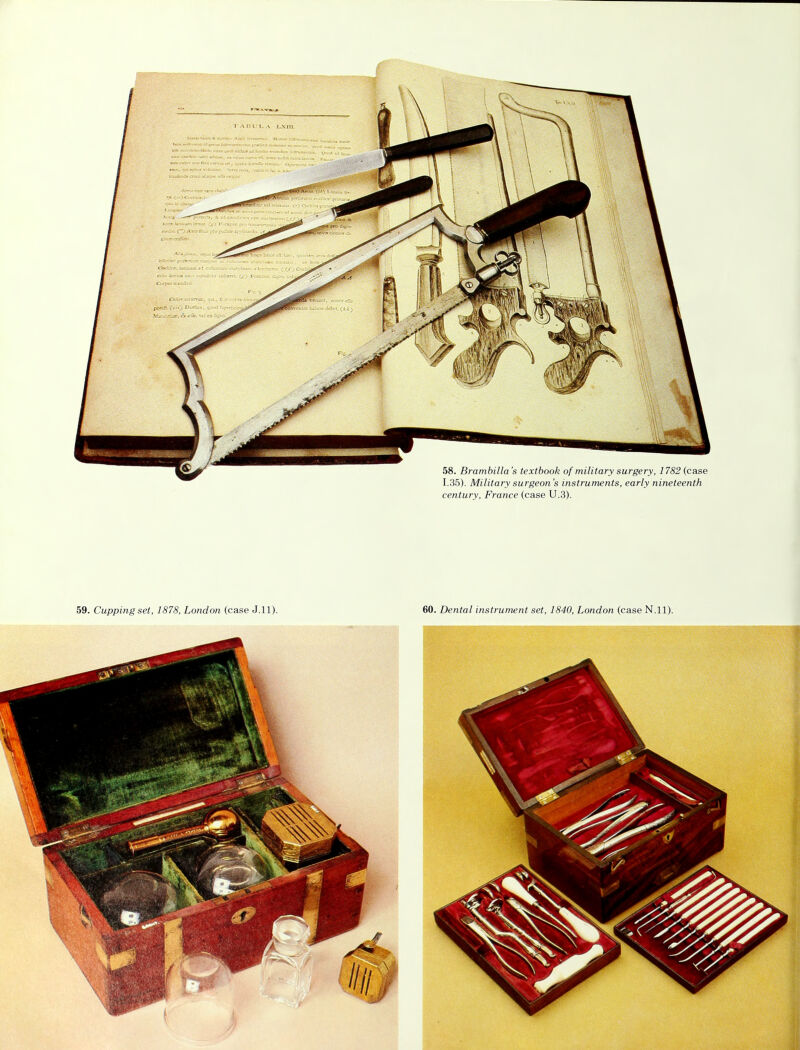 58. Brambilla's textbook of military surgery, 1782 (case 1.35). Military surgeon's instruments, early nineteenth century, France (case U.3).