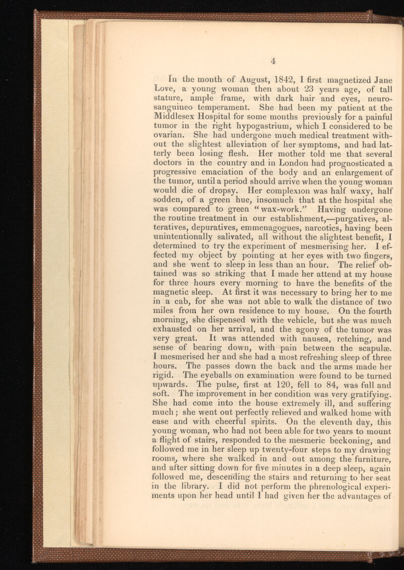 In the month of August, 1842, I first magnetized Jane Love, a young woman then about 23 years age, of tall stature, ample frame, with dark hair and eyes, neuro sanguineo temperament. She had been my patient at the Middlesex Hospital for some months previously for a painful tumor in the right hypogastrium, which I considered to be ovarian. She had undergone much medical treatment with out the slightest alleviation of her symptoms, and had lat terly been losing flesh. Her mother told me that several doctors in the country and in London had prognosticated a progressive emaciation of the body and an enlargement of the tumor, until a period should arrive when the young woman would die of dropsy. Her complexion was half waxy, half sodden, of a green hue, insomuch that at the hospital she was compared to green “wax-work.” Having undergone the routine treatment in our establishment,—purgatives, al teratives, depuratives, emmenagogues, narcotics, having been unintentionally salivated, all without the slightest benefit, I determined to try the experiment of mesmerising her. I ef fected my object by pointing at her eyes with two fingers, and she went to sleep in less than an hour. The relief ob tained was so striking that I made her attend at my house for three hours every morning to have the benefits of the magnetic sleep. At first it was necessary to bring her to me in a cab, for she was not able to walk the distance of two miles from her own residence to my house. On the fourth morning, she dispensed with the vehicle, but she was much exhausted on her arrival, and the agony of the tumor was very great. It was attended with nausea, retching, and sense of bearing down, with pain between the scapulae. I mesmerised her and she had a most refreshing sleep of three hours. The passes down the back and the arms made her rigid. The eyeballs on examination were found to be turned upwards. The pulse, first at 120, fell to 84, was full and soft. The improvement in her condition was very gratifying. She had come into the house extremely ill, and suffering much ; she went out perfectly relieved and walked home with ease and with cheerful spirits. On the eleventh day, this young woman, who had not been able for two years to mount a flight of stairs, responded to the mesmeric beckoning, and followed me in her sleep up twenty-four steps to my drawing rooms, where she walked in and out among the furniture, and after sitting down for five minutes in a deep sleep, again followed me, descending the stairs and returning to her seat in the library. I did not perform the phrenological experi ments upon her head until I had given her the advantages of