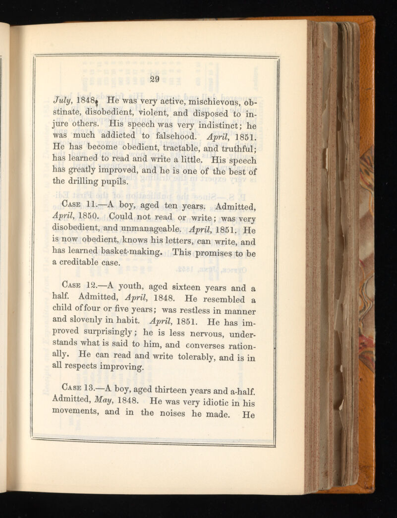 29 July , 1B48| He was very active, mischievous, ob stinate, disobedient, violent, and disposed to in jure others. His speech was very indistinct; he was much addicted to falsehood. April , 1851. He has become obedient, tractable, and truthful; has learned to read and write a little. His speech has greatly improved, and he is one of the best of the drilling pupils. Case 11.—A boy, aged ten years. Admitted, April , 1850. Could not read or write; was very disobedient, and unmanageable. April , 1851. He is now obedient, knows his letters, can write, and has learned basket-making. This promises to be a creditable case. Case 12.—A youth, aged sixteen years and a half. Admitted, April , 1848. He resembled a child of four or five years; was restless in manner and slovenly in habit. April , 1851. He has im proved surprisingly; he is less nervous, under stands what is said to him, and converses ration ally. He can read and write tolerably, and is in all respects improving. Case 18.—A boy, aged thirteen years and a-half. Admitted, May , 1848. He was very idiotic in his movements, and in the noises he made. He