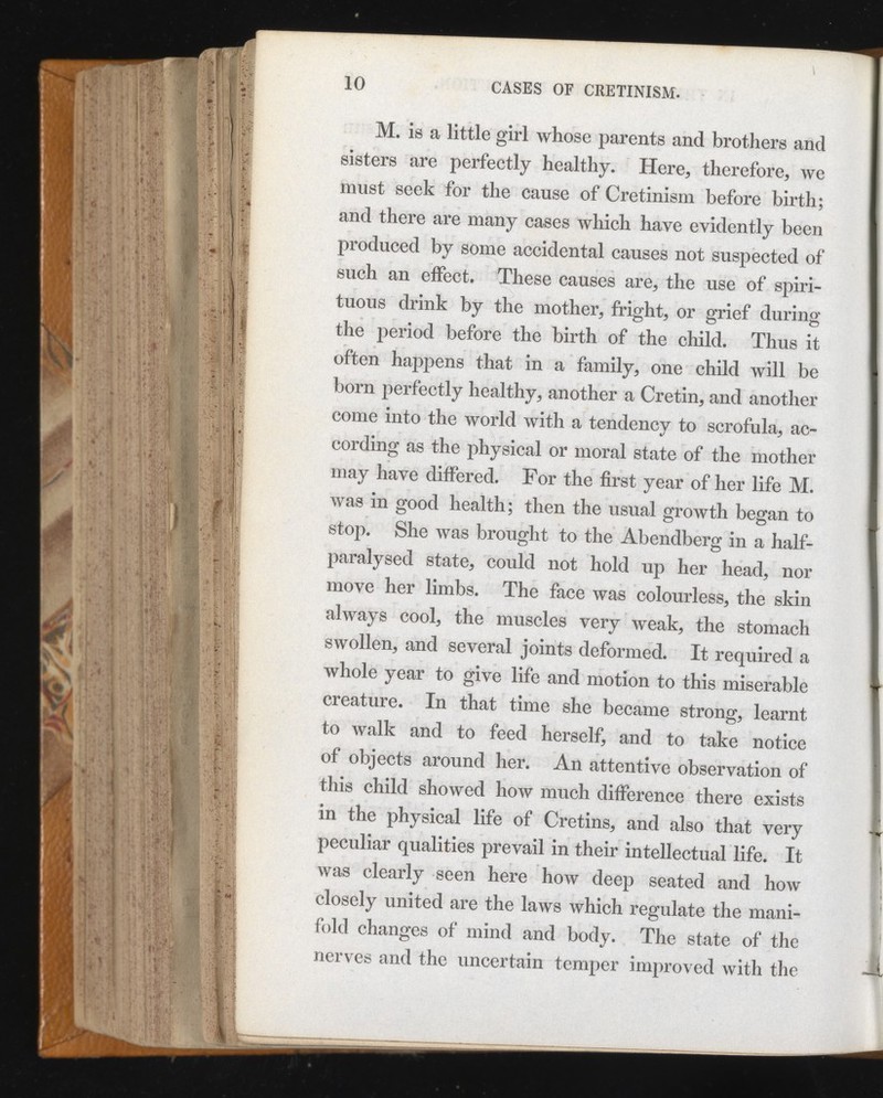 M. is a little girl whose parents and brothers and sisters are perfectly healthy. Here, therefore, we must seek for the cause of Cretinism before birth; and there are many cases which have evidently been produced by some accidental causes not suspected of such an effect. These causes are, the use of spiri tuous drink by the mother, fright, or grief during the period before the birth of the child. Thus it often happens that in a family, one child will be born perfectly healthy, another a Cretin, and another come into the world with a tendency to scrofula, ac cording as the physical or moral state of the mother may have differed. For the first year of her life M. was in good health; then the usual growth began to stop. She was brought to the Abendberg in a half- paralysed state, could not hold up her head, nor move her limbs. The face was colourless, the skin always cool, the muscles very weak, the stomach swollen, and several joints deformed. It required a whole year to give life and motion to this miserable creature. In that time she became strong, learnt to walk and to feed herself, and to take notice of objects around her. An attentive observation of this child showed how much difference there exists in the physical life of Cretins, and also that very peculiar qualities prevail in their intellectual life. It was clearly seen here how deep seated and how closely united are the laws which regulate the mani fold changes of mind and body. The state of the nerves and the uncertain temper improved with the