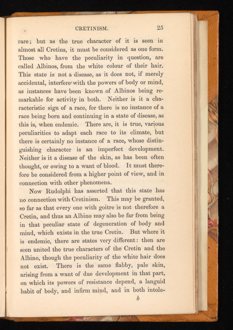 rare; but as the true character of it is seen in almost all Cretins, it must be considered as one form. Those who have the peculiarity in question, are called Albinos, from the white eolour of their hair* This state is not a disease, as it does not, if merely accidental, interfere- with the powers of body or mind, as instances have been known of Albinos being re markable for activity in both. Neither is it a cha racteristic sign of a race, for there is no instance of a race being born and continuing in a state of disease, as this is, when endemic. There are, it is true, various peculiarities to adapt each race to its climate, but there is certainly no instance of a race, whose distin guishing character is an imperfect development. Neither is it a disease of the skin, as has been often thought, or owing to a want of blood. It must there fore be considered from a higher point of view, and in connection with other phenomena. Now Rudolphi has asserted that this state has no connection with Cretinism. This may be granted, so far as that every one with goitre is not therefore a Cretin, and thus an Albino may also be far from being in that peculiar state of degeneration of body and mind, which exists in the true Cretin. But where it is endemic, there are states very different: then are seen united the true characters of the Cretin and the Albino, though the peculiarity of the white hair does not exist. There is the same flabby, pale skin, arising from a want of due development in that part, on which its powers of resistance depend, a languid habit of body, and infirm mind, and in both intole- b