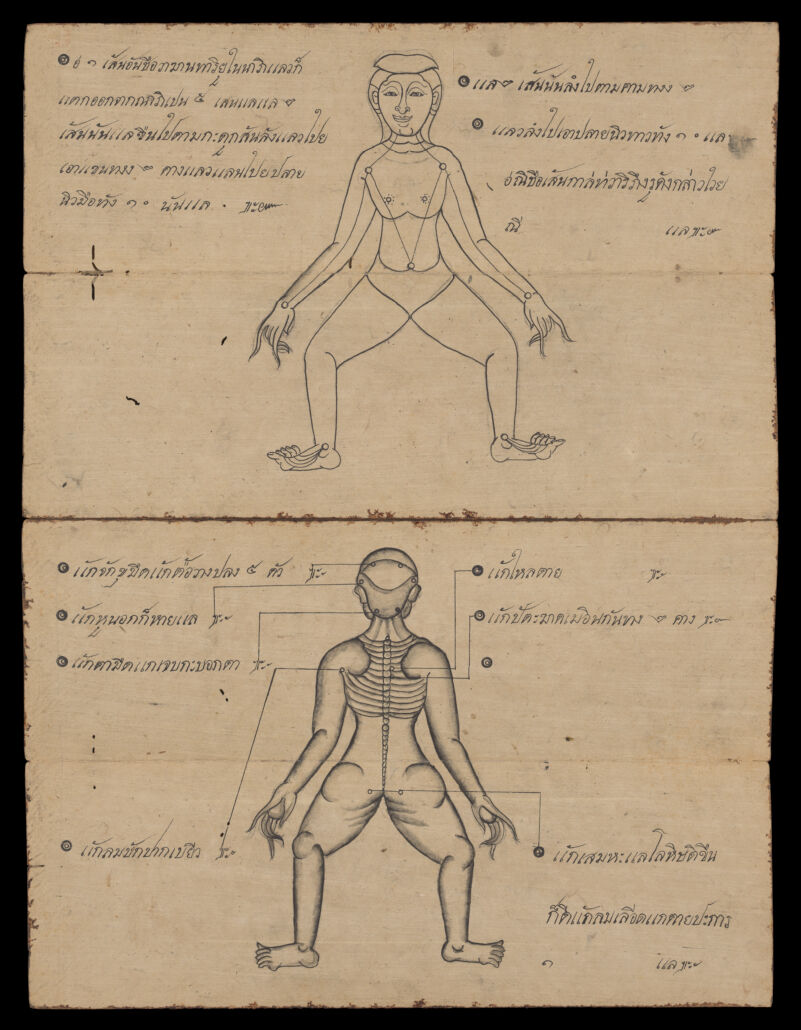 No text description is available for this image