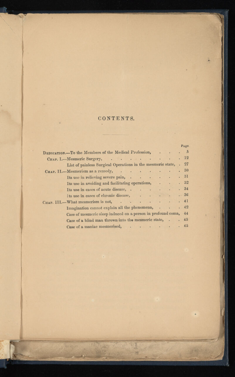 CONTENTS. Dedication. —To the Members of the Medical Profession, Chap. I.—Mesmeric Surgery, List of painless Surgical Operations in the mesmeric state, Chap. II.—Mesmerism as a remedy, Its use in relieving severe pain, .... Its use in avoiding and facilitating operations, Its use in cases of acute disease, .... its use in cases of chronic disease, Chap. III.—What mesmerism is not, Imagination cannot explain all the phenomena, Case of mesmeric sleep induced on a person in profound coma, Case of a blind man thrown into the mesmeric state, Case of a maniac mesmerised, • m