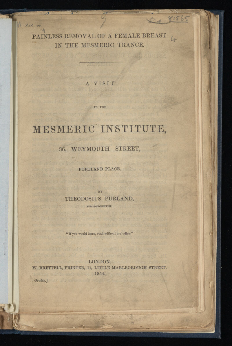 PAINLESS REMOVAL OF A FEMALE BREAST IN THE MESMERIC TRANCE. H■ A VISIT TO THE MESMERIC INSTITUTE, 36, WEYMOUTH STREET, PORTLAND PLACE. BY THEODOSIUS PURLAND, SURGEON-DENTIST. “ If you would learn, read without prejudice.’* LONDON: W. BRETTELL, PRINTER, 11, LITTLE MARLBOROUGH STREET. 1854. Gratis.]