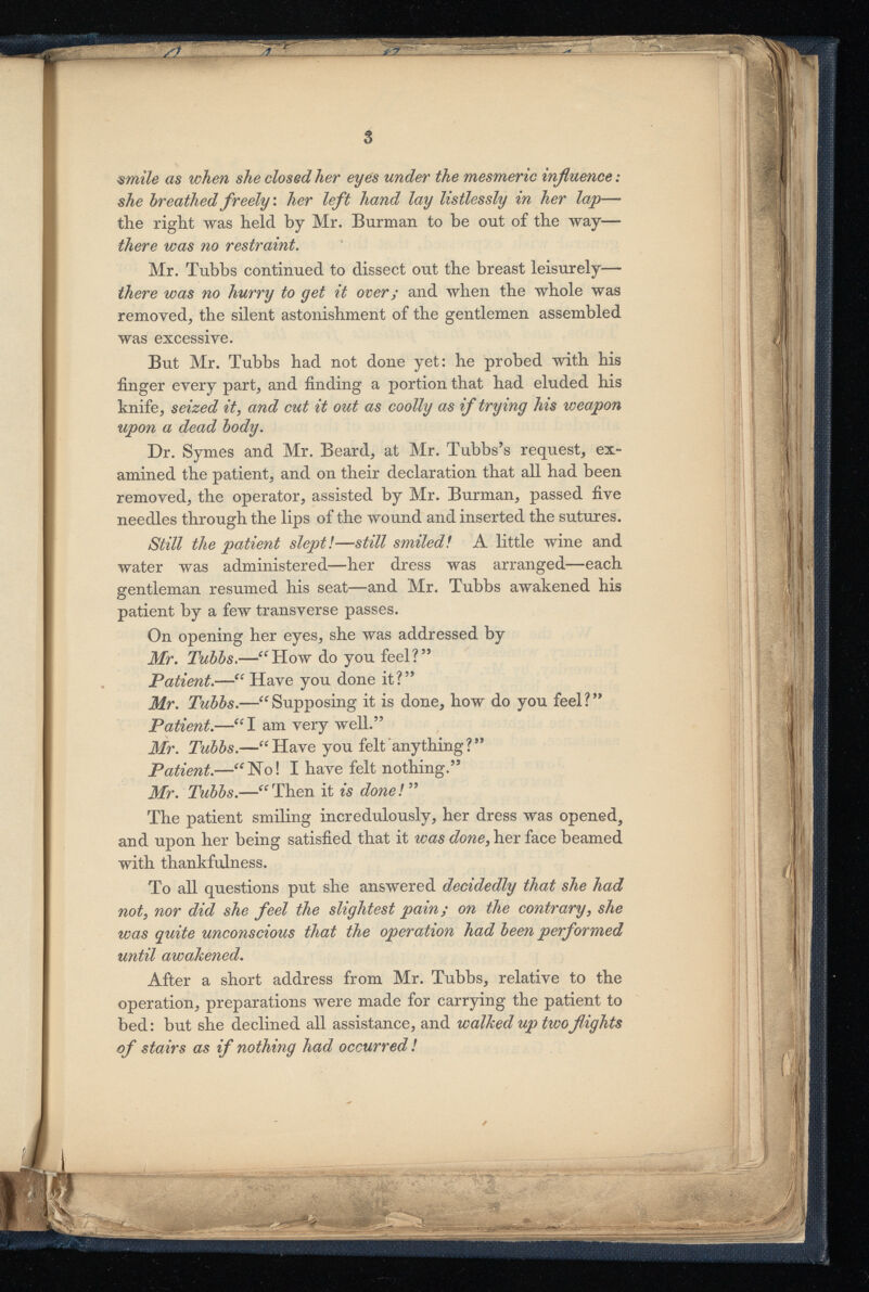 entile as when she closed her eyes under the mesmeric influence: she breathed freely : her left hand lay listlessly in her lap —* the right was held by Mr. Burman to be out of the way— there was no restraint. Mr. Tubbs continued to dissect out the breast leisurely— there was no hurry to get it over; and when the whole was removed, the silent astonishment of the gentlemen assembled was excessive. But Mr. Tubbs had not done yet: he probed with his finger every part, and finding a portion that had eluded his knife, seized it , and cut it out as coolly as if trying his weapon upon a dead body. Dr. Symes and Mr. Beard, at Mr. Tubbs’s request, ex amined the patient, and on their declaration that all had been removed, the operator, assisted by Mr. Burman, passed five needles through the lips of the wound and inserted the sutures. Still the patient slept l—still smiledl A little wine and water was administered—her dress was arranged—each gentleman resumed his seat—and Mr. Tubbs awakened his patient by a few transverse passes. On opening her eyes, she was addressed by Mr. Tubbs. —“How do you feel?” Patient .—“ Have you done it?” Mr. Tubbs .—“Supposing it is done, how do you feel?” Patient .—“I am very well.” Mr. Tubbs .—“Have you felt anything?” Patient .—“No! I have felt nothing.” Mr. Tubbs .—“Then it is donel” The patient smiling incredulously, her dress was opened, and upon her being satisfied that it was done , her face beamed with thankfulness. To all questions put she answered decidedly that she had not , nor did she feel the slightest pain; on the contrary , she was quite unconscious that the operation had been performed until awakened. After a short address from Mr. Tubbs, relative to the operation, preparations were made for carrying the patient to bed: but she declined all assistance, and walked up twoflights of stairs as if nothing had occurred !