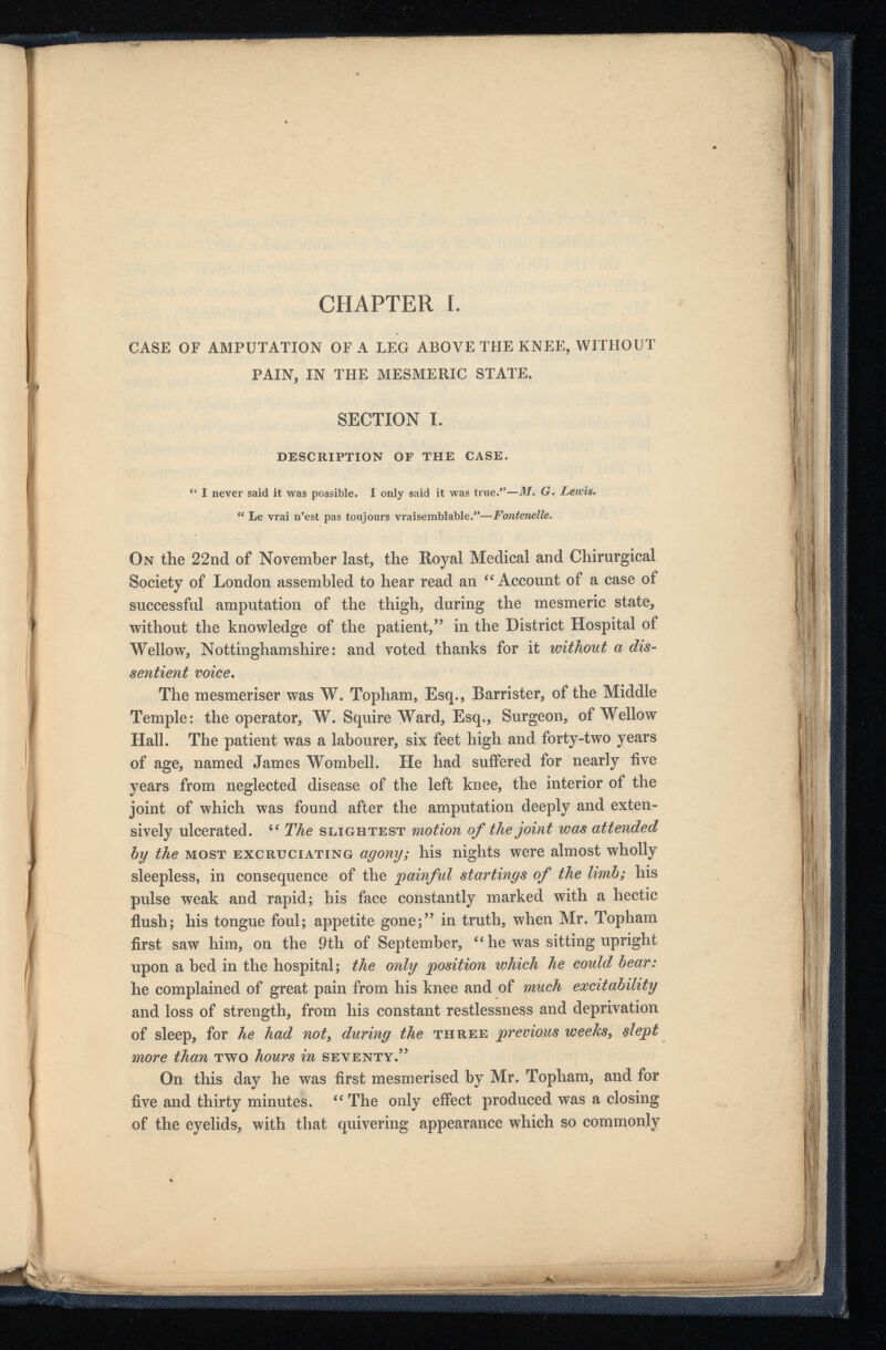 CHAPTER I. CASE OF AMPUTATION OF A LEG ABOVE THE KNEE, WITHOUT PAIN, IN THE MESMERIC STATE. SECTION I. DESCRIPTION OF THE CASE. “ I never said it was possible. I only said it was true.”— M. G. Lewis. “ Le vrai n’est pas toujours vraisemblable.”— Fontenelle. On the 22nd of November last, the Royal Medical and Chirurgical Society of London assembled to hear read an fC Account of a case of successful amputation of the thigh, during the mesmeric state, without the knowledge of the patient, 55 in the District Hospital of Wellow, Nottinghamshire: and voted thanks for it without a dis sentient voice . The mesmeriser was W. Topham, Esq., Barrister, of the Middle Temple: the operator, W. Squire Ward, Esq., Surgeon, of Wellow Hall. The patient was a labourer, six feet high and forty-two years of age, named James Wombell. He had suffered for nearly five years from neglected disease of the left knee, the interior of the joint of which was found after the amputation deeply and exten sively ulcerated. tc The slightest motion of the joint was attended by the most excruciating agony; his nights were almost wholly sleepless, in consequence of the painful startings of the limb; his pulse weak and rapid; his face constantly marked with a hectic flush; his tongue foul; appetite gone; 55 in truth, when Mr. Topham first saw him, on the 9th of September, Ci he was sitting upright upon a bed in the hospital; the only position which he could bear: he complained of great pain from his knee and of much excitability and loss of strength, from his constant restlessness and deprivation of sleep, for he had not x during the three previous weeks , slept more than two hours in seventy. 55 On this day he was first mesmerised by Mr. Topham, and for five and thirty minutes. “ The only effect produced was a closing of the eyelids, with that quivering appearance which so commonly