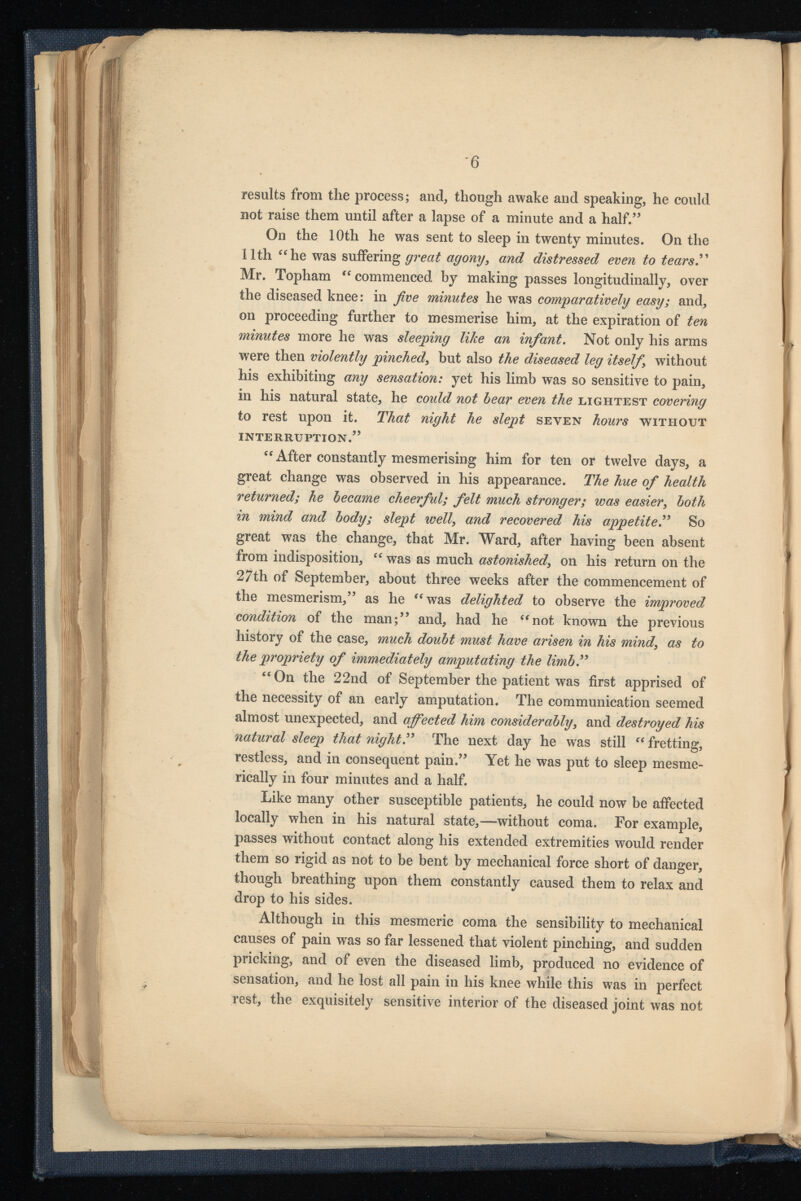 results from the process; and, though awake and speaking, he could not raise them until after a lapse of a minute and a half.” On the 10th he was sent to sleep in twenty minutes. On the 11th “he was suffering great agony , and distressed even to tears” Mr. Topham “commenced by making passes longitudinally, over the diseased knee: in five minutes he was comparatively easy; and, on proceeding further to mesmerise him, at the expiration of ten minutes more he was sleeping like an infant . Not only his arms were then violently pinched^ but also the diseased leg itself without his exhibiting any sensation: yet his limb was so sensitive to pain, in his natural state, he could not hear even the lightest covering to rest upon it. That night he slept seven hours without INTERRUPTION.” “ After constantly mesmerising him for ten or twelve days, a great change w^as observed in his appearance. The hue of health returned; he became cheerful; felt much stronger; was easier , both in mind and body; slept well , and recovered his appetite .” So great was the change, that Mr. Ward, after having been absent from indisposition, “ was as much astonished , on his return on the 27th of September, about three weeks after the commencement of the mesmerism,” as he “was delighted to observe the improved condition of the man;” and, had he “not known the previous history of the case, much doubt must have arisen in his mind , as to the propriety of immediately amputating the limb” “On the 22nd of September the patient was first apprised of the necessity of an early amputation. The communication seemed almost unexpected, and affected him considerably , and destroyed his natural sleep that night” The next day he was still “fretting, restless, and in consequent pain.” Yet he was put to sleep mesme- rically in four minutes and a half. Like many other susceptible patients, he could now be affected locally when in his natural state,—without coma. For example, passes without contact along his extended extremities would render them so rigid as not to be bent by mechanical force short of danger, though breathing upon them constantly caused them to relax and drop to his sides. Although in this mesmeric coma the sensibility to mechanical causes of pain was so far lessened that violent pinching, and sudden pricking, and of even the diseased limb, produced no evidence of sensation, and he lost all pain in his knee while this was in perfect rest, the exquisitely sensitive interior of the diseased joint was not