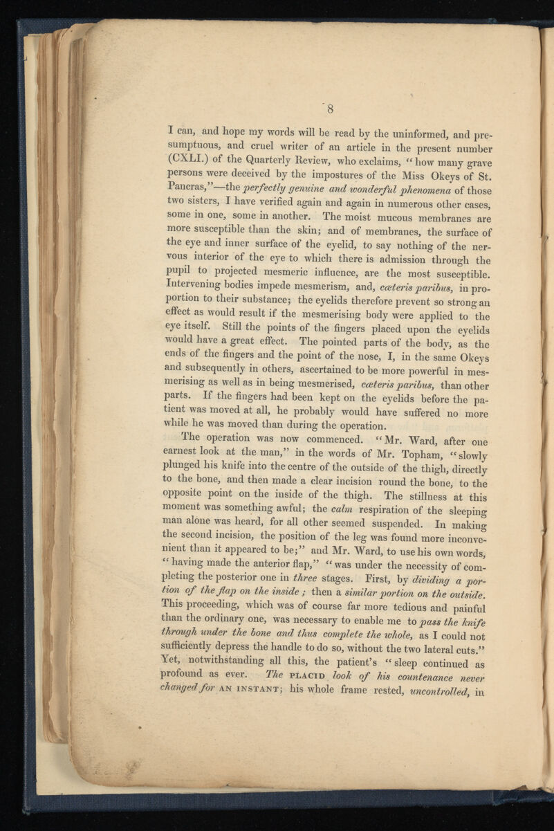 I can, and hope my words will be read by the uninformed, and pre sumptuous, and cruel writer of an article in the present number (CXLI.) of the Quarterly Review, who exclaims, “ how many grave persons were deceived by the impostures of the Miss Obeys of St. Pancras,”—the perfectly genuine and wonderful phenomena of those two sisters, I have verified again and again in numerous other cases, some in one, some in another. The moist mucous membranes are more susceptible than the skin; and of membranes, the surface of the eye and inner surface of the eyelid, to say nothing of the ner vous interior of the eye to which there is admission through the pupil to projected mesmeric influence, are the most susceptible. Intervening bodies impede mesmerism, and, cceteris paribus, in pro portion to their substance; the eyelids therefore prevent so strong an effect as would result if the mesmerising body were applied to the eye itself. Still the points of the fingers placed upon the eyelids would have a great effect. The pointed parts of the body, as the ends of the fingers and the point of the nose, I, in the same Okeys and subsequently in others, ascertained to be more powerful in mes merising as well as in being mesmerised, cceteris paribus, than other parts. If the fingers had been kept on the eyelids before the pa tient was moved at all, he probably would have suffered no more while he was moved than during the operation. The operation was now commenced. “Mr. Ward, after one earnest look at the man,” in the words of Mr. Topham, “slowly plunged his knife into the centre of the outside of the thigh, directly to the bone, and then made a clear incision round the bone, to the opposite point on the inside of the thigh. The stillness at this moment was something awful; the calm respiration of the sleeping man alone was heard, for all other seemed suspended. In making the second incision, the position of the leg was found more inconve nient than it appeared to be;” and Mr. Ward, to use his own words, “ having made the anterior flap,” “ was under the necessity of com pleting the posterior one in three stages. First, by dividing a por tion of the flap on the inside ; then a similar portion on the outside. This proceeding, which was of course far more tedious and painful than the ordinary one, was necessary to enable me to pass the knife through under the bone and thus complete the whole, as I could not sufficiently depress the handle to do so, without the two lateral cuts.” Yet, notwithstanding all this, the patient’s “ sleep continued as profound as ever. The placid look of his countenance never changed, for an instant; his whole frame rested, uncontrolled, in