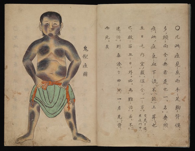 digitised image 3