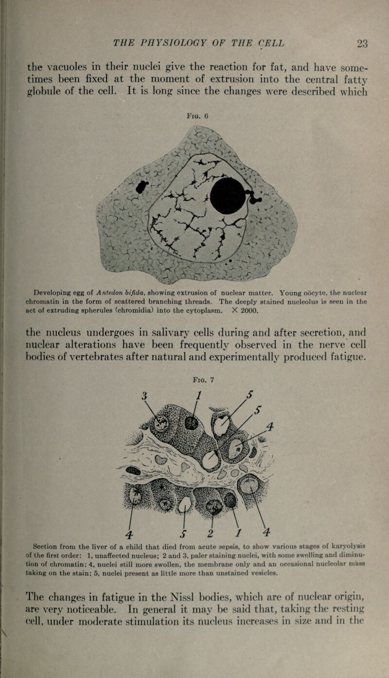 the vacuoles in their nuclei give the reaction for fat, and have some- times been fixed at the moment of extrusion into the central fatty globule of the cell. It is long since the changes were described which Fig. 6 Developing egg of Aniedon bifida, showing extrusion of nuclear matter. Young oocyte, the nuclear chromatin in the form of scattered branching threads. The deeply stained nucleolus is seen in the act of extruding spherules (chromidia) into the cytoplasm. X 2000. the nucleus undergoes in salivarj^ cells during and after secretion, and nuclear alterations have been frequently observed in the nerve cell bodies of vertebrates after natural and experimentally produced fatigue. Section from the liver of a child that died from acute sepsis, to show various stages of karyolysis of the first order: 1, unaflfected nucleus; 2 and 3, paler staining nuclei, with some swelling and diminu- tion of cliromatin; 4, nuclei still more swollen, the membrane only and an occasional nucleolar mass taking on the stain; 5, nuclei present as little more than unstained vesicles. The changes in fatigue in the Nissl bodies, which are of nuclear origin, are very noticeable. In general it may be said that, taking the resting cell, under moderate stimulation its nucleus increases in size and in the