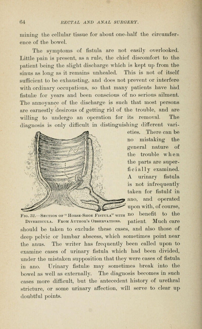 mininsr the cellular tissue for about one-half the circumfer- ence of the bowel. The symptoms of fistula are not easily overlooked. Little pain is present, as a rule, the chief discomfort to the patient being the slight discharge which is kept up from the sinus as long as it remains unhealed. This is not of itself sufficient to be exhausting, and does not prevent or interfere with ordinary occupations, so that many patients have had fistuloe for years and been conscious of no serious ailment. The annoyance of the discharge is such that most persons are earnestly desirous of getting rid of the trouble, and are willing to undergo an operation for its removal. The diagnosis is only difficult in distinguishing different vari- eties. There can be no mistaking the general nature of the trouble when the parts are super- ficially examined. A urinary fistula is not infrequently taken for fistula in auo, and operated upon with, of course, Fig. 32.—Section of  Hobse-Shoe Fistula with HO benefit to the DivEBTicuLA. Fkom Authob's Obseevations. patient, Much care should be taken to exclude these cases, and also those of deep pelvic or lumbar abscess, which sometimes point near the anus. The writer has frequently been called upon to examine cases of urinary fistula which had been divided, under the mistaken supposition that they were cases of fistula in ano. Urinary fistulse may sometimes break into the bowel as well as externally. The diagnosis becomes in such cases more difficult, but the antecedent history of urethral stricture, or some urinary affection, will serve to clear up doubtful points.