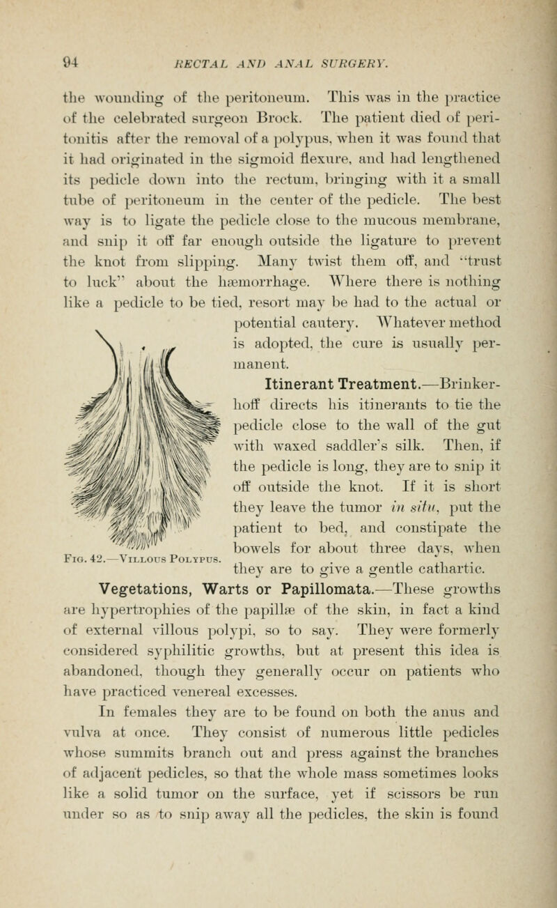 the wouiuling of the peritoneum. This was in the practice of the celebrated surgeon Brock. The patient died t)f [)eri- tonitis after the removal of a polypus, when it was found that it had originated in the sigmoid flexure, and had lengthened its pedicle down into the rectum, briuging with it a small tube of peritoneum in the center of the pedicle. The best way is to ligate the pedicle close to the mucous membrane, and snip it off far enough outside the ligature to prevent the knot from slipping. Many twist them off, and 'trust to luck about the hasmorrhage. Where there is nothing like a pedicle to be tied, resort may be had to the actual or potential cautery. Whatever method is adopted, the cure is usually per- manent. Itinerant Treatment.—Brinker- lioff directs his itinerants to tie the pedicle close to the wall of the gut with waxed saddler's silk. Then, if the pedicle is long, they are to snip it off outside the knot. If it is short they leave the tumor in situ, put the patient to bed, and constipate the bowels for about three days, when they are to give a gentle cathartic. Vegetations, Warts or Papillomata.^—These growths are hypertrophies of the papillae of the skin, in fact a kind of external villous polypi, so to say. They were formerly considered syphilitic growths, but at present this idea is abandoned, though they generally occur on patients who have practiced venereal excesses. In females they are to be found on both the anus and vulva at once. They consist of numerous little pedicles whose summits branch out and press against the branches of adjacent pedicles, so that the whole mass sometimes looks like a solid tumor on the surface, yet if scissors be run under so as to snip away all the pedicles, the skin is found