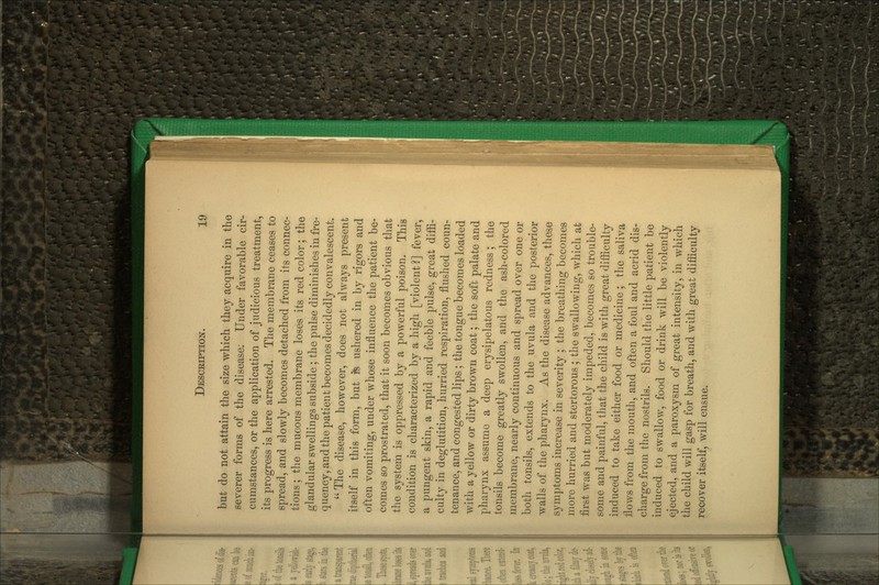 but do not attain the size wliich they acquire in the severer forms of the disease; Under favorable cir- cumstances, or the application of judicious treatment, its progress is here arrested. The membrane ceases to spread, and slowly becomes detached from its connec- tions ; the mucous membrane loses its red color; the glandular swellings subside ; the pulse diminishes in fre- quency, and the patient becomes decidedly convalescent.  The disease, however, does not ahvays present itself in this form, but is ushered in by rigoi-s and often vomiting, under whose influence the patient be- comes so prostrated, that it soon becomes obvious that tlie system is oppressed by a powerful poison. This condition is characterized by a high [violent?] fever, a pungent skin, a rapid and feeble ]3iilse, great diffi- culty in deglutition, hurried respiration, flushed coun- tenance, and congested lips; the tongue becomes loaded with a yellow or dirty brown coat; the soft palate and pharynx assume a deep erysipelatous redness; the tonsils become greatly swollen, and the ash-colored membrane, nearly continuous and spread over one or both tonsils, extends to the uvula and the posterior walls of the pharynx. As the disease advances, these sj^mptoms increase in severity ; the breathing becomes more hurried and stertorous ; the swallowing, which at first w^as but moderately impeded, becomes so trouble- some and painful, that the child is with great difficulty induced to take either food or medicine; the saliva flows from the mouth, and often a foul and acrid dis- charge from the nostrils. Should the little patient be induced to swallow, food or drink will be violently ejected, and a paroxysm of great intensity, in which the child will gasp for breath, and with great difficulty recover itself, will ensue.