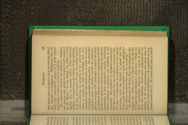 Our author does not seem to have the remotest idea of any rationale of mah'gnaiicy. Malignancy does not imply any '' superadded poison, but a great amount or quantity of poison, or a feeble organism. The distinction between the diptheritic exudation and apthous sore mouth, or thrush^ is well explained by Dr. Wood:  In the thrush, the white coating appears first in separate points, which afterward coalesce; is formed upon the surface of the epidermis, or at least not beneath it; may be readily removed without affecting the integrity of the mucous mem- brane, or causing the least hemorrhage, and, when examined under the microscope, is found to contain abundantly a peculiar fungous plant. The diptheritic exudation forms in patches, heneath the epidennis; adheres strongly to the membrane, so that it can rarely be detached without causing the extravasation of some blood; and under the microscope exhibits the ordinary constituents of false membrane; namely, interlacing fibrils, molecules or granules, and exudation or pus corpuscles. The exudation in scarlatina occurs gener- ally first in points, like the thrush, is much less cohe- sive than the diptheritic, less adherent to the mucous membrane, much less disposed to spread into the larynx, and also less disposed to make its appearance upon surfaces elsewhere that may be excoriated. Dr. McDonald, of Bristol, Eng. {Braiihwaite^s Met- rospect^ Jan., 1860), says, in relation to the identity of diptheria and malignant scarlet fever :  There has been considerable confusion with respect to scarlet fever and diptheria. Some have contended for the identity of the two, maintaining that those cases in which no rash appeared were to be considered as ' sup- pressed scarlet fever.' To combat this view, it will be