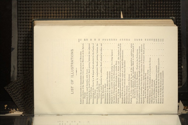LIST OF ILLUSTRATIONS. Kuder's experiments to demonstrate the production of Meteorism . . 11 Great sacculation of the Transverse Colon due to a Stricture at the Splenic Flexure ........ 20 Stricture of the small Intestine with Pouch . . . . .22 Strangulation by a broad Peritoneal Band passing between two adjacent Coils of lleum .... ... 30 Strangulation of the Ileurn by a Y-shaped Band attached to the Fundus of  the Uterus ........ 32 Strangulation of the lloum l>y complicated Bands passing between the Uterus and Ovary . . . . . . .33 Strangulation of small Intestine by a solitary Band attached at either end to the Mesentery . . . . . . .34 Strangulation by a Baud . . . . . . .37 Strangulation by an adherent Diverticle . . . .. .47 Strangulation by Meckel's Diverticulum . . . . .48 Diagram to show a possible method of snaring by a long ligament . 40 One mode of Strangulation by the Diverticulum . . . .50 Strangulation by the Diverticulum by a double Knot . . .51' Portion of lleum strangulated by a fibrous cord (the remains of the omphalo-mesenteric duct) which terminated in a rounded mass of fat 51 Stenosis of the lleum above the origin of a Meckel's Diverticulum . . 53 Multiple Sacculi or Diverticula of the Small Intestine . . - . 58 Distension Diverticula . . . . . . .60 Diverticulum of the Lower Jejunum . . . . .61 Portion of Colon constricted by one of the appendices epiploicai which hns become adherent to the omentum, which is itself attached to the bowel by moderate adhesions , Go Site of congenital hole in the Mesentery ; Pouch in the Peritoneum . 67 Strangulation of small Intestine through a hole in the Great Omentum . 69 Stenosis of ascending Colon from the contraction of Peritoneal Adhesions. 89 Sigmoid Flexure showing a broad membranous Peritoneal Band passing from the Mesocolon to the Gut . . . . .90 Adhesions forming the Bowel into a Loop . . . . .92 Fistula bimucosK, with formation of a Loop in the lleum . . .93 Diffused Peritoneal Adhesions . . . . . .95 The Fossa Duodeno-jejunalis . . . .108 Small Hernia into the Fossa Duodeno-jejunalis .... 109 Hernia of medium size into the Fossa Duodeno-jejunalis . . .110 Hernia in the Fossa Duodeno-jejunalis . . . . .111 Hernia into the Fossa Duodeno-jejunalis . . . . .112