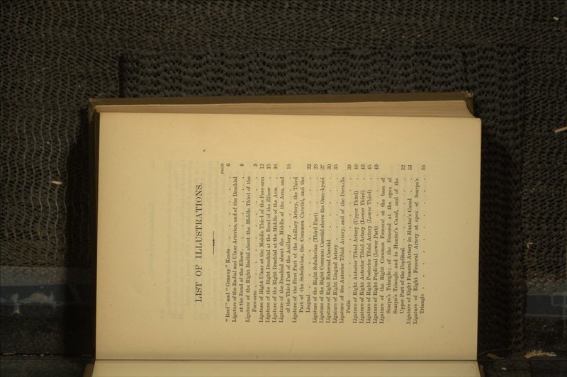 LIST OF ILLUSTRATIONS.  Keef  and  Granny  Knots 6 Ligature of the Radial and Ulnar Arteries, and of the Brachial at the Bend of the Elbow 8 Ligature of the Eight Radial about the Middle Third of the Fore-arm 9 Ligature of Right Ulnar at the Middle Third of the Fore-arm 12 Ligature of the Right Brachial at the Bend of the Elbow . 15 Ligature of the Right Brachial at the Middle of the Arm . 16 Ligature cf the Brachial about the Middle of the Arm, and of the Third Part of the Axillary 18 Ligature of the First Part of the Axillary Artery, the Third Part of the Subclavian, the Common Carotid, and the Lingual 22 Ligature of the Right Subclavian (Third Part) ... 23 Ligature of the Right Common Carotid above the Omo-hyoid 27 Ligature of Right External Carotid 30 Ligature of Right Lingual Artery ...... 35 Ligature of the Anterior Tibial Artery, and of the Dors.ilis Pedis 39 Ligature of Right Anterior Tibial Artery (Upper Third) . 40 Ligature of Right Anterior Tibial Artery (Lower Third) . 42 Ligature of Right Posterior Tibial Artery (Lower Third) . 45 Ligature of Right Popliteal (Lower Part) .... 49 Ligature of the Right Common Femoral at the base of Scarpa's Triangle; of the Femoral at the apex of Scarpa's Triangle and in Hunter's Canal, and of the Upper Part of the Popliteal 52 Ligature of Right Femoral Artery in Hunter's Canal . . 53 Ligature of Right Femoral Artery at apex of Scarpa's Triangle 55