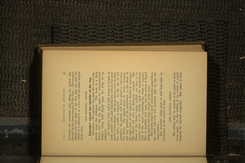 situation are attached only along the narrow line formed by the inner margin of the tibia. The surgeon should not lose sight of the fact that the part for which he is aiming is in a line with the outer margin of the tibia. THE PERONEAL ARTERY. Ligature about the middle of the leg. Operation.—The patient lies upon the sound side> almost upon the abdomen. The knee is a little flexed, and the leg lies upon its antero-internal surface, being held firmly upon the table by an assistant. An incision, three and a half inches in length, is made parallel with, and immediately behind, the outer border of the fibula. The fascia having been divided, the soleus muscle is exposed. At the site of the operation the muscle will have ceased to arise from the fibula. The muscle must be drawn inwards, and any portion of its attachment to the fibula in the upper part of the wound is divided if necessary. The fibula will now be distinctly exposed. The fibres of the flexor longus pollicis are then to be severed close to the fibula, until the membranous wall of the canal containing the vessel is exposed. This is carefully laid open, and the artery is found lying against the inner margin of the bone. The needle may be most conveniently passed from the outer side, and will probably take up also the veme comites. The muscular tissue must be well held aside by retractors, as the wound is deep. THE POPLITEAL ARTERY. The artery may be secured at its upper or at its lower part. In the middle of its course it would scarcely be exposed surgically. The vessel is here