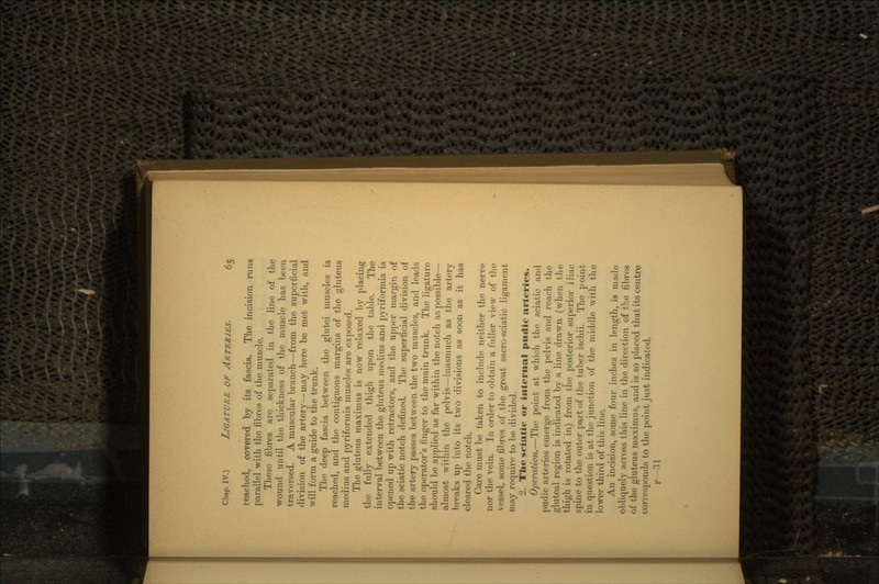 reached, covered by its fascia. The incision runs parallel with the fibres of the muscle. These fibres are separated in the line of the wound until the thickness of the muscle has been traversed. A muscular branch—from the superficial division of the artery—may here be met with, and will form a guide to the trunk. The deep fascia between the glutei muscles is reached, and the contiguous margins of the gluteus medius and pyriformis muscles are exposed. The gluteus maximus is now relaxed by placing the fully extended thigh upon the table. The interval between the gluteus medius and pyriformis is opened up with retractors, and the upper margin of the sciatic notch defined. The superficial division of the artery passes between the two muscles, and leads the operator's finger to the main trunk. The ligature should be applied as far within the notch as possible— almost within the pelvis—inasmuch as the artery breaks up into its two divisions as soon as it has cleared the notch. Care must be taken to include neither the nerve nor the vein. In order to obtain a fuller view of the vessel, some fibres of the great sacro-sciatic ligament may require to be divided. 2. The sciatic or internal puclic arteries. Operation.—The point at which the sciatic and pudic arteries emerge from the pelvis and reach the gluteal region is indicated by a line drawn (when the thigh is rotated in) from the posterior superior iliac spine to the outer part of the tuber ischii. The point in question is at the junction of the middle with the lower third of this line. An incision, some four inches in length, is made obliquely across this line in. the direction of the fibres of the gluteus maximus, and is so placed that its centre corresponds'to the point just indicated. F-31