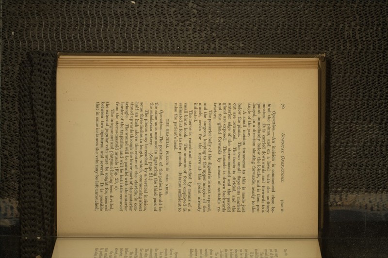 Operation.—An incision is commenced close be- hind the pinna, and on a level with the auditory meatus. It is carried downwards and forwards to a point immediately below the lobule, and is then pro- longed, in a direction slanting forwards, nearly to the angle of the jaw. A small incision transverse to this is made just below the pinna. The two small flaps thus marked out are retracted. The fascia is divided, and the anterior edge of the sterno-mastoid and the parotid gland are exposed. The muscle is drawn backwards and the gland forwards by means of suitable re- tractors. The posterior belly of the digastric is next exposed, and the surgeon, keeping to the upper margin of the muscle, seeks for the nerve at the point already indicated. The nerve is raised and stretched by means of a small blunt hook. The amount of force employed is estimated at four to five pounds. It is not sufficient to raise the patient's head. THE BRACHIAL PLEXUS IN THE NECK. Operation.—The position of the patient should be the same as is assumed in ligaturing the third part of the subclavian artery. (See page 21.) The plexus may be reached by a vertical incision, some three inches in length, which, commencing about half an inch above the centre of the clavicle, is con- tinued upwards through the lower part of the posterior triangle. The wound will be parallel with the anterior border of the trapezius, and will be but little removed from the sterno-mastoid muscle (Fig. 23, c). The integument and platysma having been divided, the external jugular vein must be sought for, secured between two ligatures, and severed. It is possible that in some instances the vein may be left untouched,