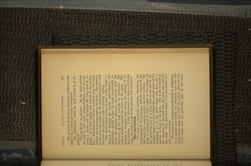 The presence of the stone should be verified by the staff or by a sound previously introduced. The position in which the staff is held is of im- portance. Two positions are advised. By the older method the staff is held quite perpendicularly, and its con- cavity is drawn well up against the bony arch of the pubes. It is held rigidly and exactly in the median line. The assistant's thumb is placed upon the rough handle, while his fingers grasp the shaft. The assistant at the same time holds up the penis and scrotum, and sees that the perineal raphe is exactly vertical. The other position is that advised by Mr. Cadge :— Instead of keeping the handle perpendicular, the staff-holder should incline his hand considerably to- wards the patient's abdomen, and gently push the convexity of the staff towards the perineum. The staff is steadied against the front of the pubes. This position is assumed only during the making of the first incision. While the second or deep cut is being made, the staff is held in the position first described. The operation. The first or superficial incision.—Steadying the integuments of the perineum with the fingers of the left hand, the surgeon makes the first incision. The knife is introduced at right angles to the surface of the perineum, and at a point just to the left of the median raphe, and just behind the central point of the perineum, i.e. in the adult about one inch and a quarter in front of the anus. The knife is thrust in the direction of the staff, and its point may just hit the staff. This first movement is of the nature of a stab or a puncture. The incision is completed as the knife is withdrawn. It is carried downwards and outwards into the left ischio-rectal fossa, and ends at a point between the tuber ischii and the posterior part of the anus,