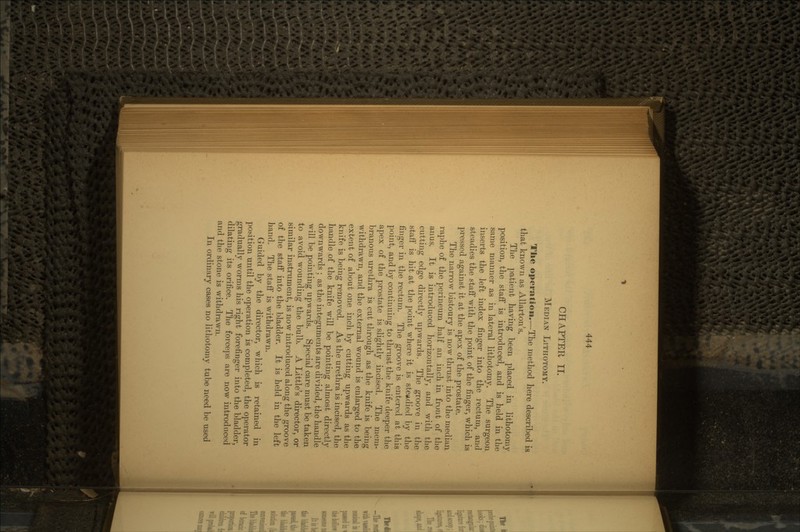 CHAPTER II. MEDIAN LITHOTOMY. The operation.—The method here described is that known as Allarton's. The patient having been placed in lithotomy position, the staff is introduced, and is held in the same manner as in lateral lithotomy. The surgeon inserts the left index finger into the rectum, and steadies the staff with the point of the finger, which is pressed against it at the apex of the prostate. The narrow bistoury is now thrust into the median raphe of the perineum half an inch in front of the anus. It is introduced horizontally, and with the cutting edge directly upwards. The groove in the staff is hit at the point where it is steadied by the finger in the rectum. The groove is entered at this point, and by continuing to thrust the knife deeper the apex of the prostate is slightly incised. The mem- branous urethra is cut through as the knife is being withdrawn, and the external wound is enlarged to the extent of about one inch by cutting upwards as the knife is being removed. As the urethra is incised, the handle of the knife will be pointing almost directly downwards ; as the integuments are divided, the handle will be pointing upwards. Special care must be taken to avoid wounding the bulb. A Little's director, or similar instrument, is now introduced along the groove of the staff into the bladder. It is held in the left hand. The staff is withdrawn. Guided by the director, which is retained in position until the operation is completed, the operator gradually worms his right forefinger into the bladder, dilating its orifice. The forceps are now introduced and the stone is withdrawn. In ordinary cases no lithotomy tube need be used