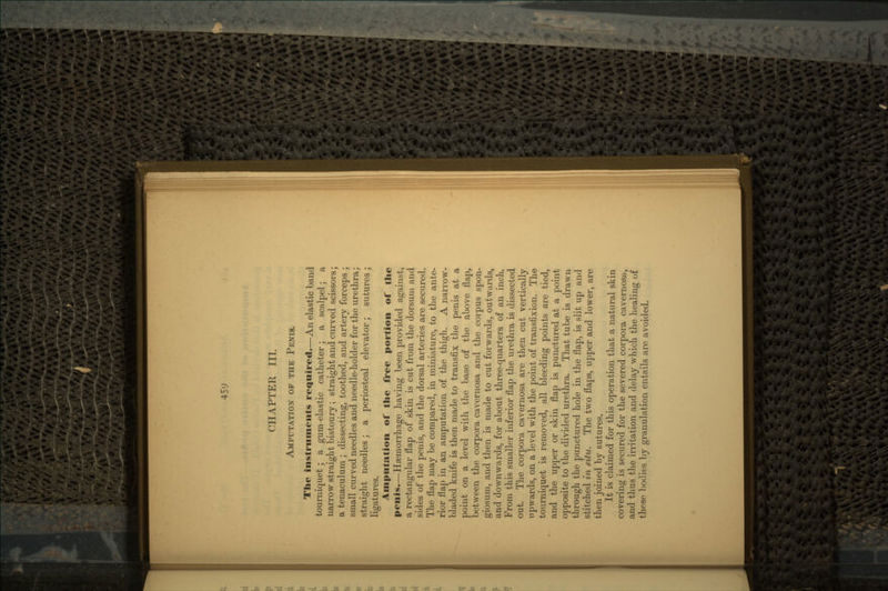 CHAPTER III. AMPUTATION OF THE PENIS. The instruments required.—An elastic band tourniquet; a gum-elastic catheter; a scalpel; a narrow straight bistoury; straight and curved scissors; a tenaculum ; dissecting, toothed, and artery forceps ; small curved needles and needle-holder for the urethra; straight needles; a periosteal elevator; sutures; ligatures. Amputation of the free portion of the penis.—Haemorrhage having been provided against, a rectangular flap of skin is cut from the dorsum and sides of the penis, and the dorsal arteries are secured. The flap may be compared, in miniature, to the ante- rior flap in an amputation of the thigh. A narrow- bladed knife is then made to transfix the penis at a point on a level with the base of the above flap, between the corpora cavernosa and the corpus spon- giosum, and then is made to cut forwards, outwards, and downwards, for about three-quarters of an inch. From this smaller inferior flap the urethra is dissected out. The corpora cavernosa are then cut vertically upwards, on a level with the point of transfixion. The tourniquet is removed, all bleeding points are tied, and the upper or skin flap is punctured at a point opposite to the divided urethra. That tube is drawn through the punctured hole in the flap, is slit up and stitched in situ. The two flaps, upper and lower, are then joined by sutures. It is claimed for this operation that a natural skin covering is secured for the severed corpora cavernosa, and thus the irritation and delay which the healing of these bodies by granulation entails are avoided.