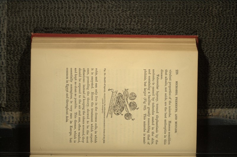 virulent properties of the microbe. Hansen considers that alkalis, not acids, are the best antiseptics in this disease. Tubercular leprosy, termed elephantiasis by the ancients, is caused by tubercles seated in the skin, and containing a bacillus greatly resembling that of phthisis, but larger (Fig. 92). This microbe is anae- Fig. 92.—Bacilli of leprosy, encysted in the subcutaneous connective tissue of the skin (^much enlarged). robic, and can only live in the dermic cells, in which it is encysted. Hence the treatment which experi- ence, preceding the theory, showed to be the most efficacious: instead of keeping the ulcers covered, they should be exposed to the air and sun, often washed, and kept as clean as possible. This disease, which is essentially contagious, is very rare in Europe, but common in Egypt and throughout Asia.