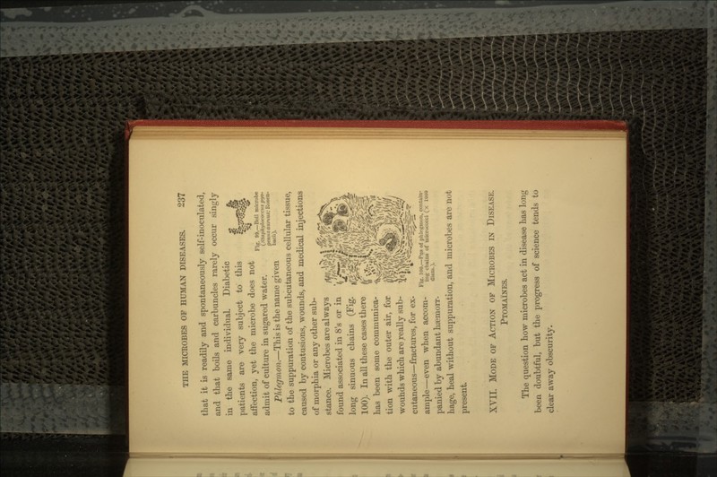 Fig. 99.—Boil microbe (Stcti>h ifltwciia pi/o- genusdurtus: Rosen- bach). that it is readily and spontaneously self-inoculated, and that boils and carbuncles rarely occur singly in the same individual. Diabetic patients are very subject to this affection, yet the microbe does not admit of culture in sugared water. Phlegmon.—This is the name given to the suppuration of the subcutaneous cellular tissue, caused by contusions, wounds, and medical injections of morphia or any other sub- stance. Microbes are always found associated in 8's or in long sinuous chains (Fig. 100). In all these cases there has been some communica- tion with the outer air, for wounds which are really sub- cutaneous—fractures, for ex- ample—even when accom- panied by abundant haemorr- hage, heal without suppuration, and microbes are not present. Fig. 100.—Pus of phlegmon, contain- ing chains of micrococci (x 1UOO diam.). XVII. MODE OF ACTION OF MICROBES IN DISEASE. PTOMAINES. The question how microbes act in disease has long been doubtful, but the progress of science tends to clear away obscurity.