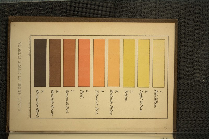 LiyMYdlow. 3. Tellow. 4*. Reddish Bllow. 5. Tcllowslt.Re.fi. G Red. 7. BromisliJlecJ. 8 HeddishHrown BrowidskMack VO GEL'S SCALE OF URINE TINTS.