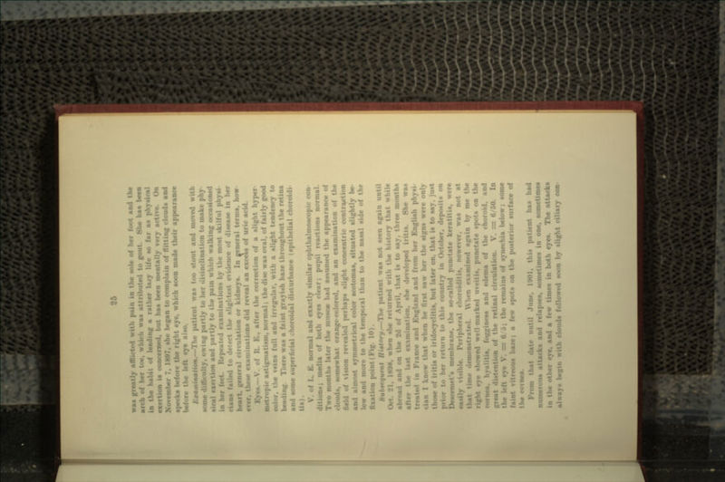 II was greatly afl! .• aole of her foot and the .-.I to gout She has beta leading a rather In/y life ao far aa physical •n ia concerned, but has been mentally very active. On »ber 7, 1897, she began to complain .loud* and •pecka before the right eye, which aoon made their appearance be/or. eye alao. Examination, vac too stout and moved \\ith aome • : --wing partly to lination to make phy- sical exertion and partly to the pain which walking occasioned l*ated examinations by the moat skilful physi ciana failed to detect the slightest evidence of disease in her heart, general circul.r ulneya. In general terms, how these examinations did reveal an excels of uric acid. . after the correction of a alight hyper metropic astigmatism, normal; the disc waa oval, of fairly good color, the veins full and irregular, with a slight tendency to beading. There waa a faint grayish haze throughout the retina and aome superficial choroidal disturbance (epithelial choroidi V. of L. E. normal and exactly similar ophthalmoscope •lition*; media of both eyea clear; pupil reactions normal. Two month* later the muse* had a*sumed the appearance of clouds, somewhat orange-colored, and an examination of the field of \ision revealed perhaps slight concentric contraction and almost symmetrical color scotomas, situated slightly be- low an ! in. i.- to tht> t.-n:j.. nl ti .m to the nasal side of the fixation j> <»). Kubtequmt flisfory.—The patient waa not seen again until 08, when she returned with the history that ut.il.- abroad and on the 2d of April, that is to say, three month* Ust examination, she developed iritis. She was ! in France and England and from her English ; it when he first saw her the signs were only those of iritis or iridocyclitis. but later on. that is to aa> af rrtmn to thi- .-onntry in October, deposits on Descemet's membrane, the so-called punctate keratitis, were eauily visible. Peripheral choroiditis, nowever, was not at Demonstrated. \V! • ••<! again by me the bowed well-marked mctate spots on the cornea, hyalitia, foggineaa and edema of the choroid. and great ulation. V. = 6/50. In >ic remains of synechia below; aome faint vitreous ha/e; a few spots on the posterior surface of th« cornea. l-Mii. this patient has had n'inn-1.-i- attacks and relapses, sometimes in one, sometimes in th. Mies in both eyea. The attacks iMi clouds followed soon by slight ciliary con-