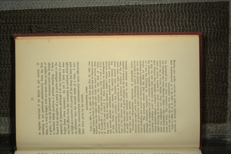 at regular intervals if we desire to get result*. If sweating is not produced satisfactorily from the first dose, it is well to begin with not more than an eighth of a grain; it can be judiciously increased until the dosage is reached which produces a profuse sweating. I have found that an eighth of a grain is quite sufficient in the majority of instances, although I do not hesitate to give larger doses when necessary. As yet I have not seen any bad effects from the treatment as outlined, although as high as a quarter of a grain of the drug has been used on alternate days for several weeks at a time. I con- sider its administration subcutaneously more efficacious than when given by the mouth. XLLUSTBATOT CASES. CASK 1.—MM. J. B., aged 40, first seen Nov. 23, 1001, had foggy vision in front of right eye with left half of objects more blurn •• right half and could see wavy vertical lines in front more marked toward the left half of vision. ^20/30 — J. via and with glasses (105 + 0.50 + 0.75) ^20/15 and words J. ii. Some difficulty in distinguish- ing colors. Field of vision showed a relative central scotoma and several absolute scotomata scattered over lower portion 1. Fields for color absent. No npecific history. The ophthalmoscope revealed a fine hyalitis with several small partially movable vitreous opacities at the upper inner quad- reous near the posterior surface of the lens. Although there were no gross changes in the fundus a number of small rhoroidrtl exudates could be seen situated between disc and the macula. Treatment.—Hypodermic injections of pilocarpin hydro- chlorate one-eight grain with increasing doses of a saturated >n of potassium iodid considerably cleared up the chor- 11 ion and cause ous opacities to disappear ;.-. The scotomata cleared and the field for colors, reappeared. In February she had a re- turn of (he symptoms but no vitreous opacities, although the idal exudates could be «1. pen and the field of vision showed almost a complete absolute ring scotoma with I'lurring at fixation point. A smaller course of treat- in, -lit \\u« mi.forgone and after taking twelve of the sweats irring where the absolute sco- toma had been. Her condition since then has gradually im- : eye feels very comfortable. CASE 2.- B. B., aged 20, L. E. chorioretinitis with patches of • horoidal atrophy in macular region and floating