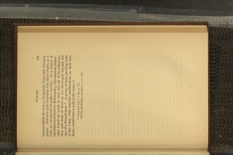 tumors which develop so frequently from this ductless gland. Ovarian cysts doubtless take their origin, as a rule, as overgrown Graaflan vesicles. In a tumor of this kind described by Rokitansky, this eminent pathol- ogist found an ovum in each and all of its numerous sacs, and none of them as yet developed beyond the size of a French bean. * A group of these growing cysts of the ovary, with vascular ramifications on their sur- faces, constitutes a poly cystic tumor, f *  Nouveau diet., t. xix, p. 740. tFollin and Duplay, ut supra, t. i, p. 108.