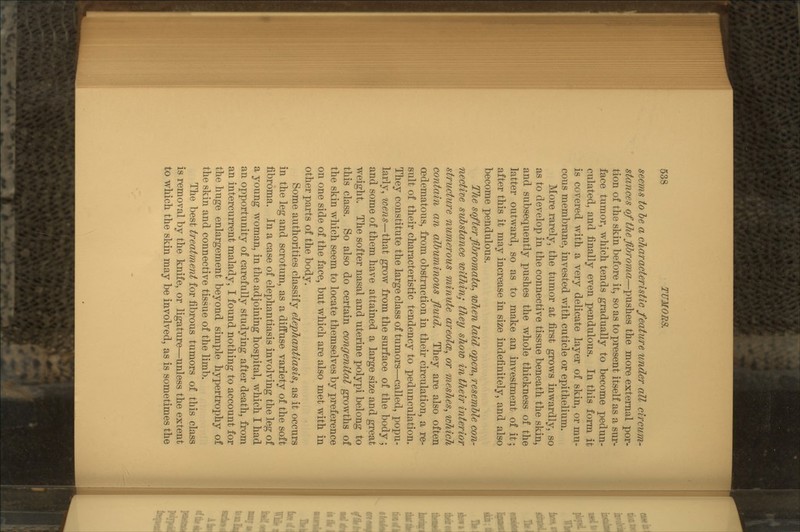 seems to be a characteristic feature under all circum- stances of the fibroma—pushes the more external por- tion of the skin before it, so as to present itself as a sur- face tumor, which tends gradually to become pedun- culated, and finally even pendulous. In this form it is covered with a very delicate layer of skin, or mu- cous membrane, invested with cuticle or epithelium. More rarely, the tumor at first grows inwardly, so as to develop in the connective tissue beneath the skin, and subsequently pushes the whole thickness of the latter outward, so as to make an investment of it; after this it may increase in size indefinitely, and also become pendulous. Tlie softer fibromata, when laid open, resemble con- nective substance within; they show in their interior structure numerous minute areolce, or meshes, which contain an albuminous fluid. They are also often oedematous, from obstruction in their circulation, a re- sult of their characteristic tendency to pedunculation. They constitute the large class of tumors—called, popu- larly, wens—that grow from the surface of the body ; and some of them have attained a large size and great weight. The softer nasal and uterine polypi belong to this class. So also do certain congenital growths of the skin which seem to locate themselves by preference on one side of the face, but which are also met with in other parts of the body. Some authorities classify elephantiasis, as it occurs in the leg and scrotum, as a diffuse variety of the soft fibroma. In a case of elephantiasis involving the leg of a young woman, in the adjoining hospital, which I had an opportunity of carefully studying after death, from an intercurrent malady, I found nothing to account for the huge enlargement beyond simple hypertrophy of the skin and connective tissue of the limb. The best treatment for fibrous tumors of this class is removal by the knife, or ligature—unless the extent to which the skin may be involved, as is sometimes the