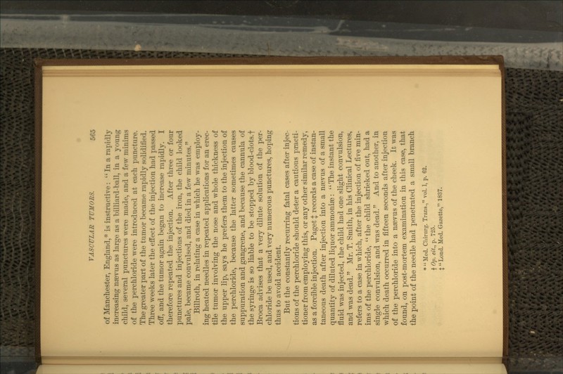 of Manchester, England,* is instructive: In a rapidly increasing nsevus as large as a billianl-l>all, in a young child, several punctures were made, and a few in in in is of the perchloride were introduced at each }>nnrtim>. The greater part of the tumor became rapidly solid! ii* •• 1. Three weeks later the effect of the injection ha<l ] off, and the tumor again began to increase rapidly. I therefore repeated the injection. After three or four punctures and injections of the iron, the child looked pale, became convulsed, and died in a few minutes. Billroth, in relating a case in which he was employ- ing heated needles in repeated applications for an erec- tile tumor involving the nose and whole thickness of the upper lip, says he prefers them to the injection of the perchloride, because the latter sometimes causes suppuration and gangrene, and because the cannula of the syringe is so liable to be stopped by blood-clots, f Broca advises that a very dilute solution of the per- chloride be used, and very numerous punctures, hoping thus to avoid accident. But the constantly recurring fatal cases after injec- tions of the perchloride should deter a cautious practi- tioner from employing this, or any other similar remedy, as a forcible injection. Paget \ records a case of instan- taneous death after injection into a nsevus of a small quantity of diluted liquor ammonise:  The instant the fluid was injected, the child had one slight convulsion, and was dead. Mr. T. Smith, in his Clinical Lectures, refers to a case in which, after the injection of five min- ims of the perchloride, the child shrieked out, had a single convulsion, and was dead. And to another, in which death occurred in fifteen seconds after injection of the perchloride into a ngevus of the cheek. It was found, on post-mortem examination in this case, that the point of the needle had penetrated a small branch *  Med. Chirurg. Trans., vol. 1, p. 62. f Op. cit., p. 725. jLond. Med. Gazette, 1837.