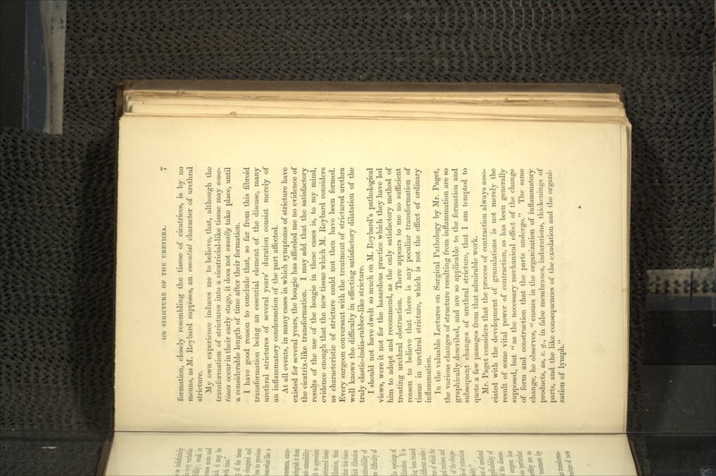 formation, closely resembling the tissue of cicatrices, is by no means, as M. Reybard supposes, an essential character of urethral stricture. My own experience induces me to believe, that, although the transformation of strictures into a cicatricial-like tissue may some- times occur in their early stage, it does not usually take place, until a considerable length of time after their formation. I have good reason to conclude that, so far from this fibroid transformation being an essential element of the disease, many urethral strictures of several years' duration consist merely of an inflammatory condensation of the part affected. At all events, in many cases in which symptoms of stricture have existed for several years, the bougie has afforded me no evidence of the cicatrix-like transformation. I may add that the satisfactory results of the use of the bougie in these cases is, to my mind, evidence enough that the new tissue which M. Reybard considers as characteristic of stricture could not then have been formed. Every surgeon conversant with the treatment of strictured urethra well knows the difficulty in effecting satisfactory dilatation of the truly elastic-india-rubber-like stricture. I should not have dwelt so much on M. Rcybard's pathological views, were it not for the hazardous practice which they have led him to adopt and recommend, as the only satisfactory method of treating urethral obstruction. There appears to me no sufficient reason to believe that there is any peculiar transformation of tissue in urethral stricture, which is not the effect of ordinary inflammation. In the valuable Lectures on Surgical Pathology by Mr. Paget, the various changes of structure resulting from inflammation are so graphically described, and are so applicable to the formation and subsequent changes of urethral stricture, that I am tempted to quote a few passages from that admirable work. Mr. Paget considers that the process of contraction always asso- ciated with the development of granulations is not merely the result of some vital power of contraction, as has been generally supposed, but  as the necessary mechanical effect of the change of form and construction that the parts undergo. The same change, he observes,  ensues in the organization of inflammatory products, as, e. g., in false membranes, indurations, thicken ings of parts, and the like consequences of the exudation and the organi- zation of lymph.